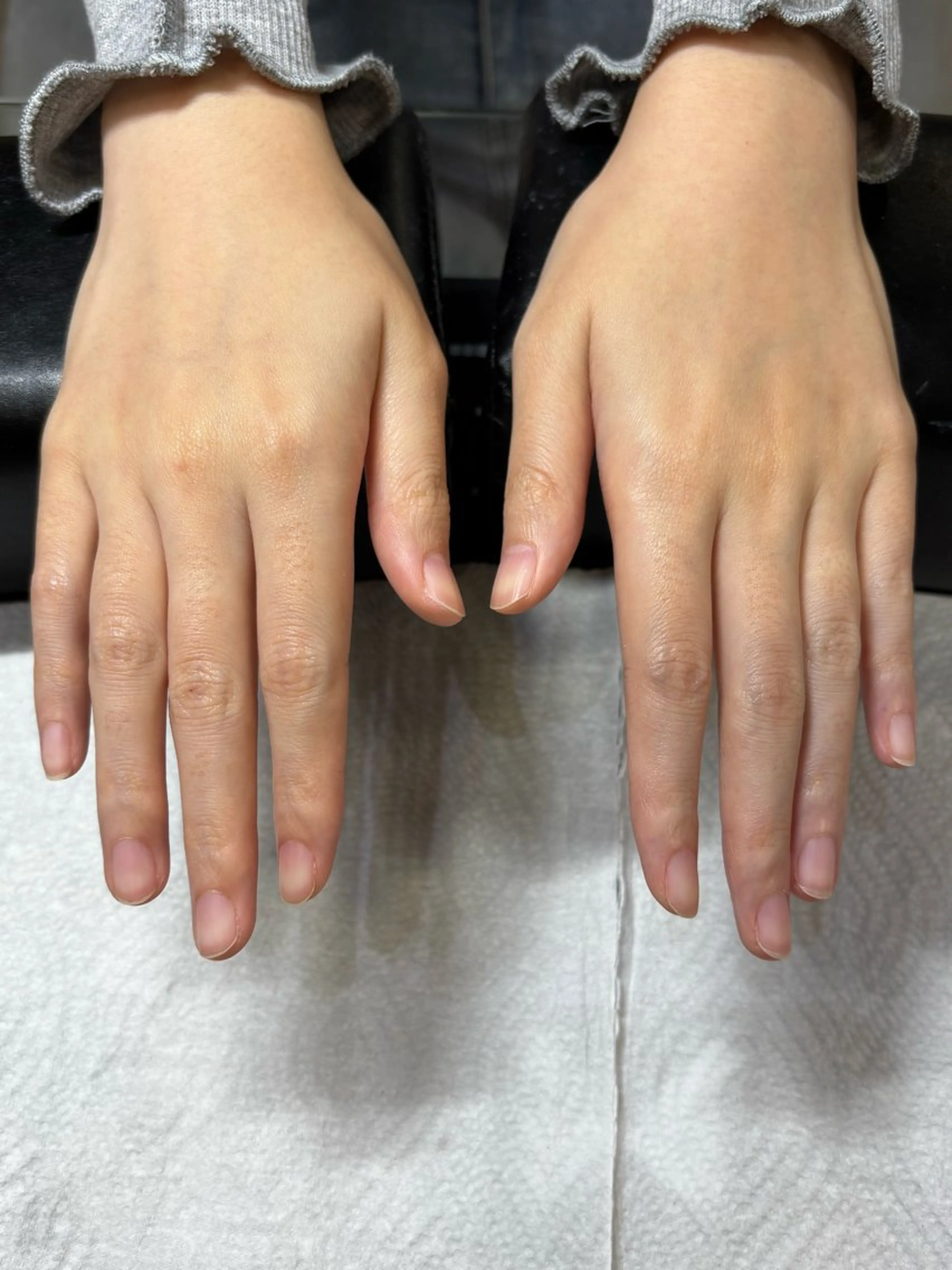 ハンドオフのみ（ケアなし）の写真