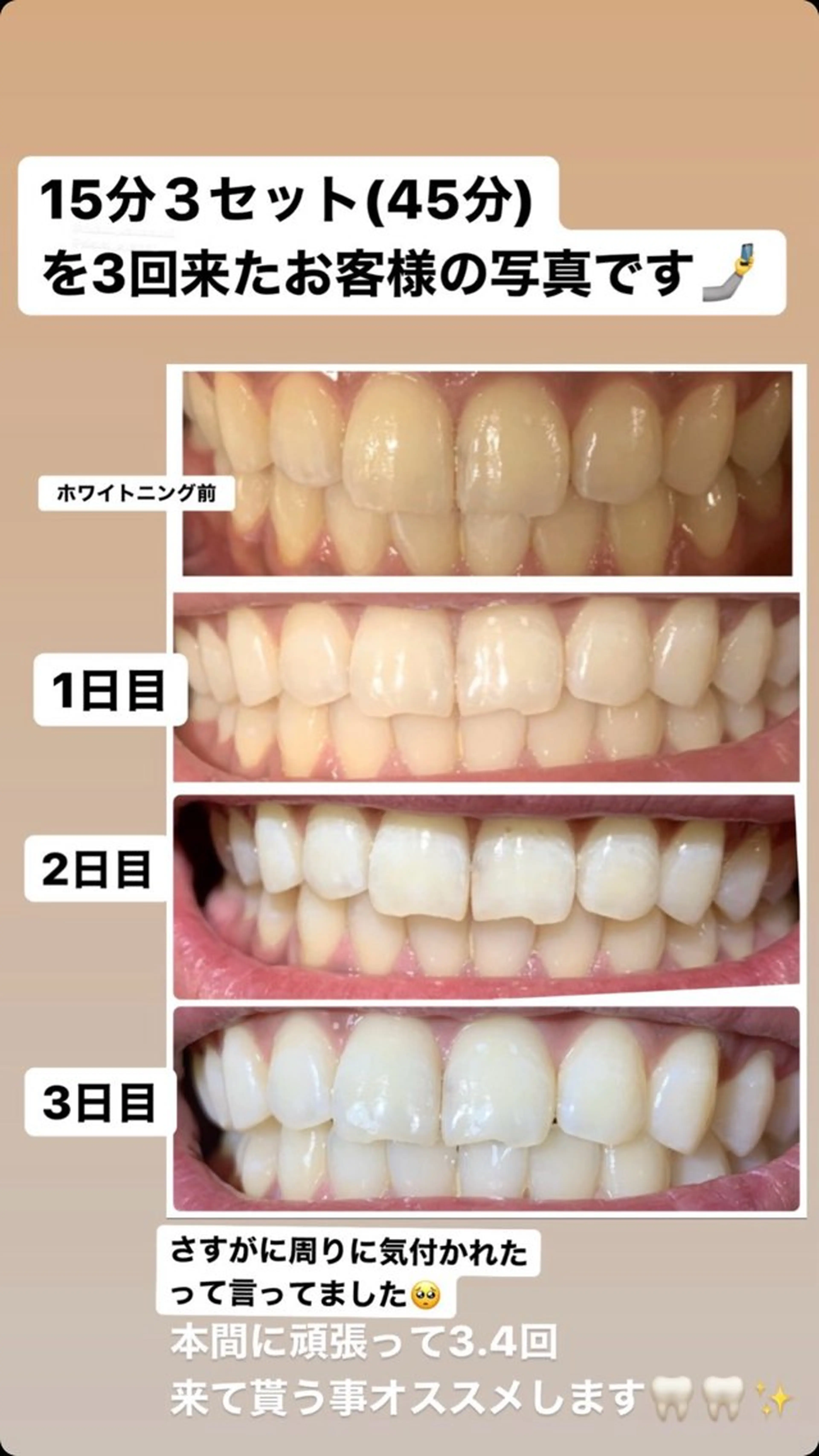 その他 peco nail所属・中村 由紀乃のその他イメージ