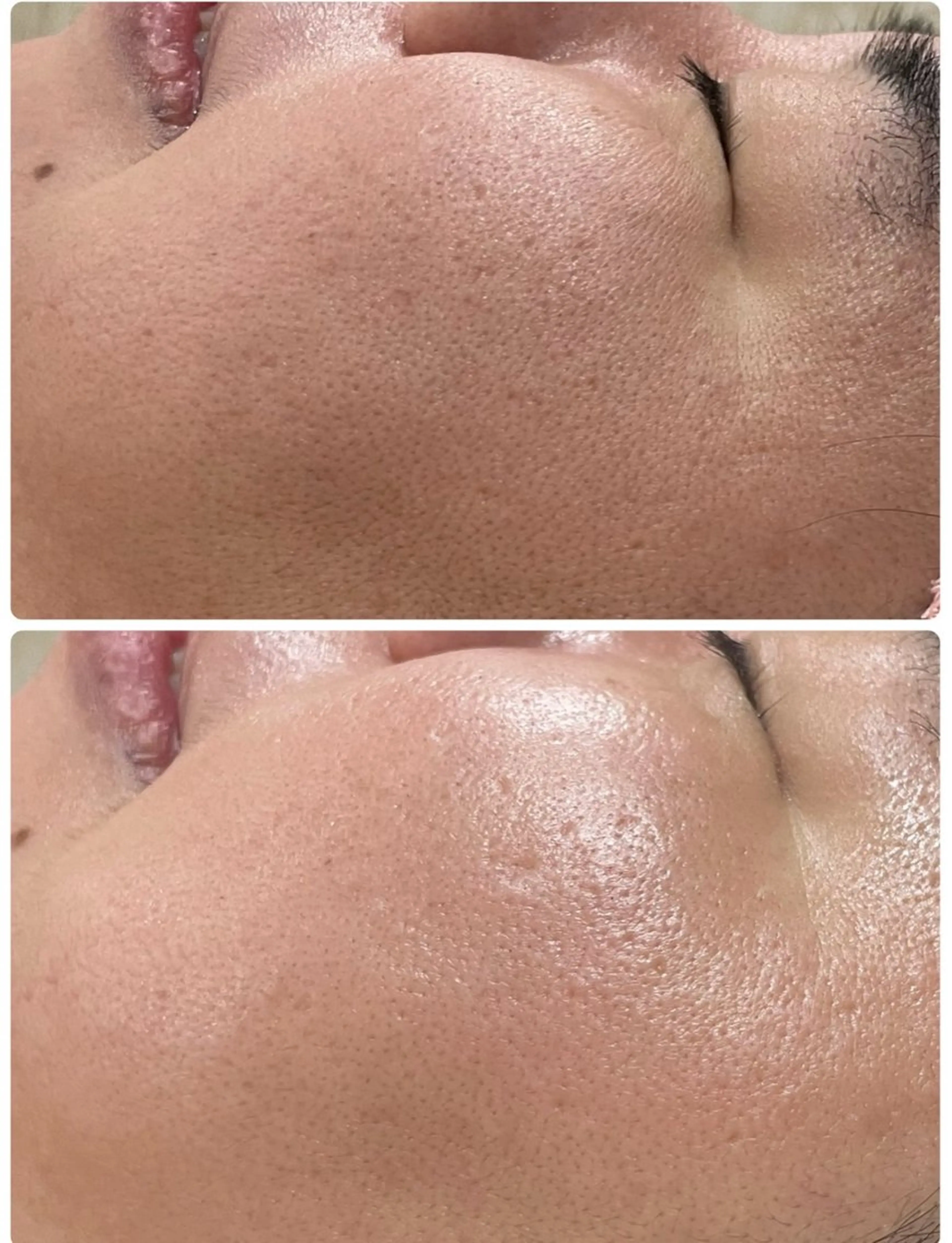 エステ矢野 ジョアアンジェ心斎橋のエステ・リラクイメージ