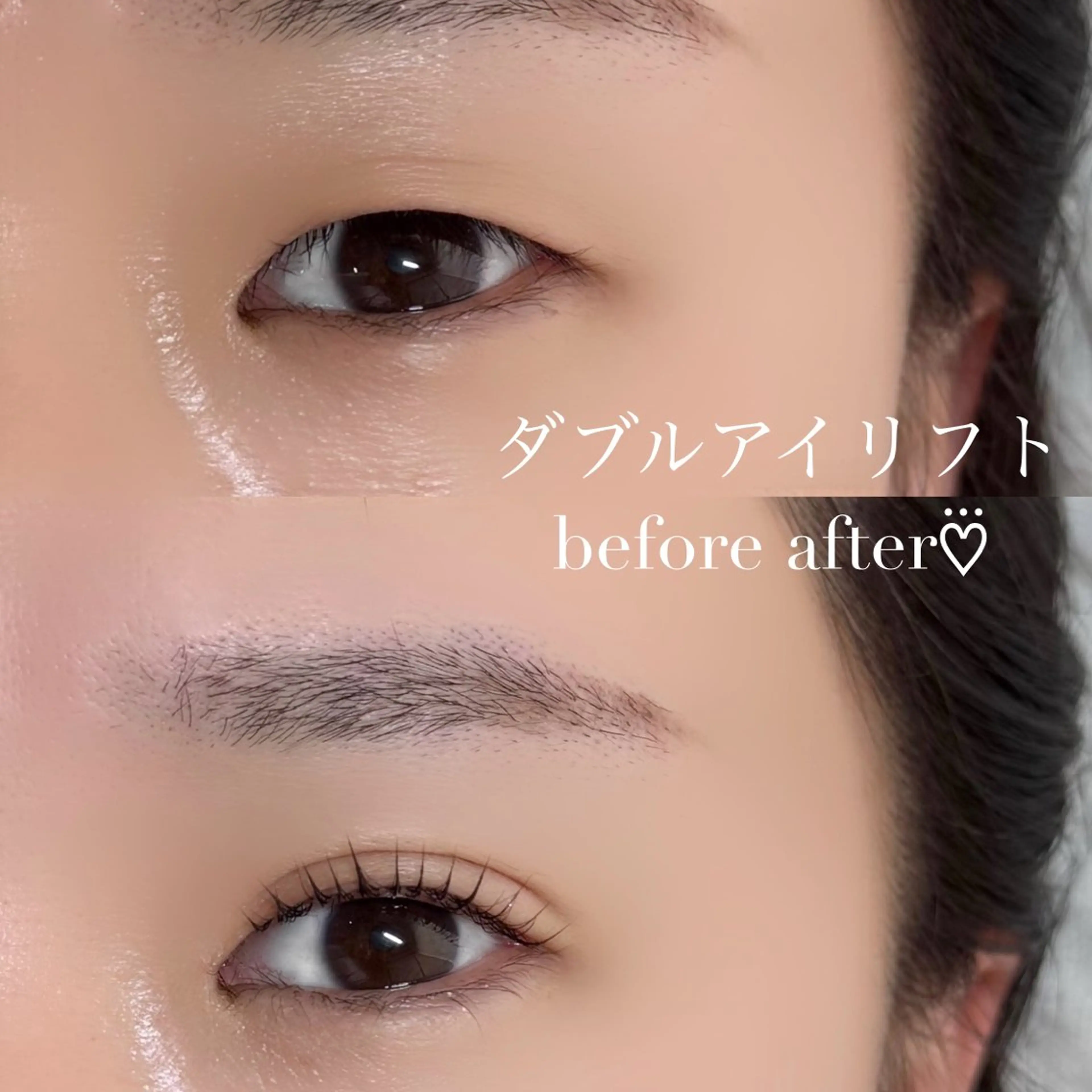 【最新美容整体 × 最新まつげパーマ】ダブルアイリフト🫧の写真