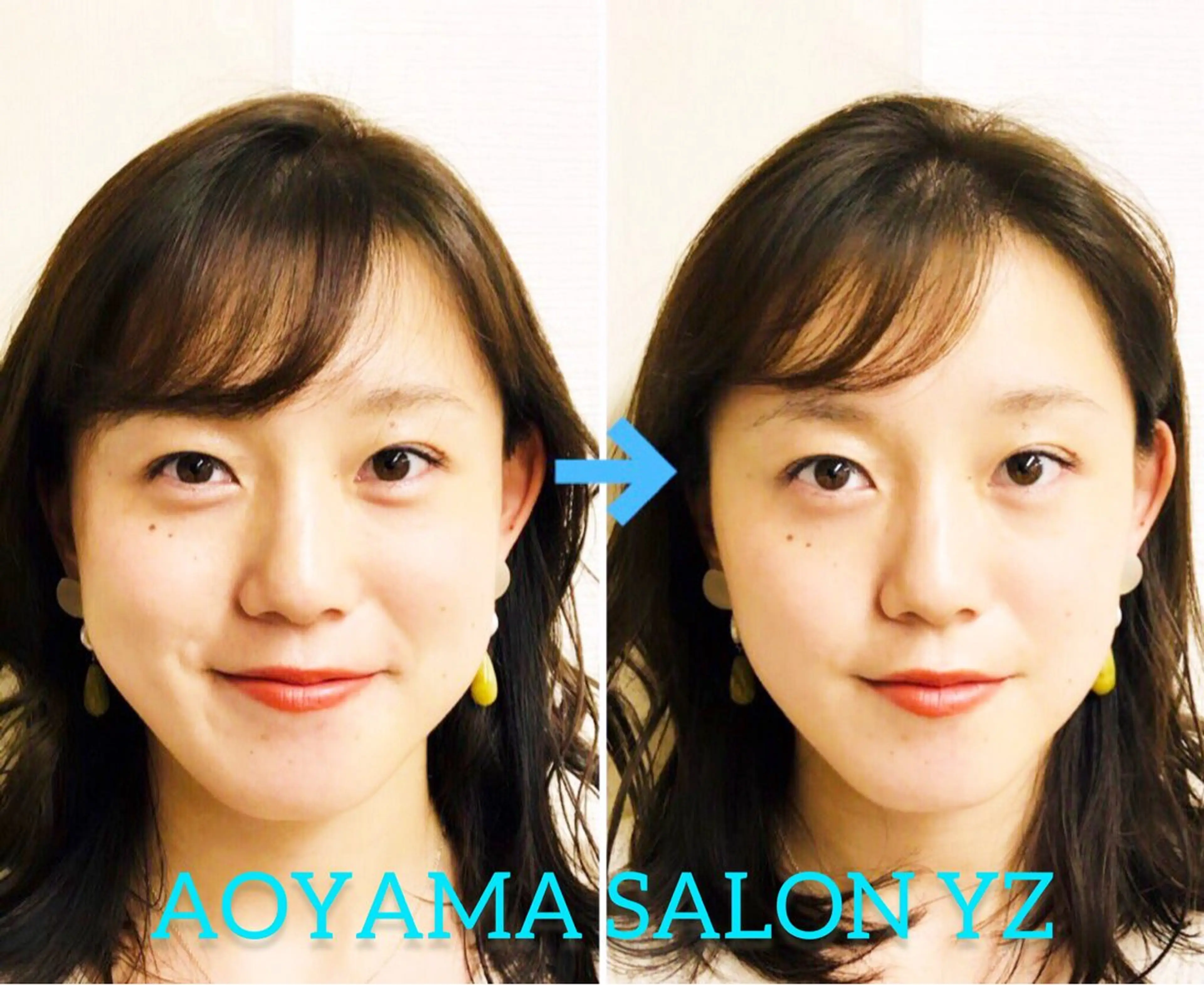 小顔美容鍼専門サロン 渋谷YZのエステ・リラクイメージ