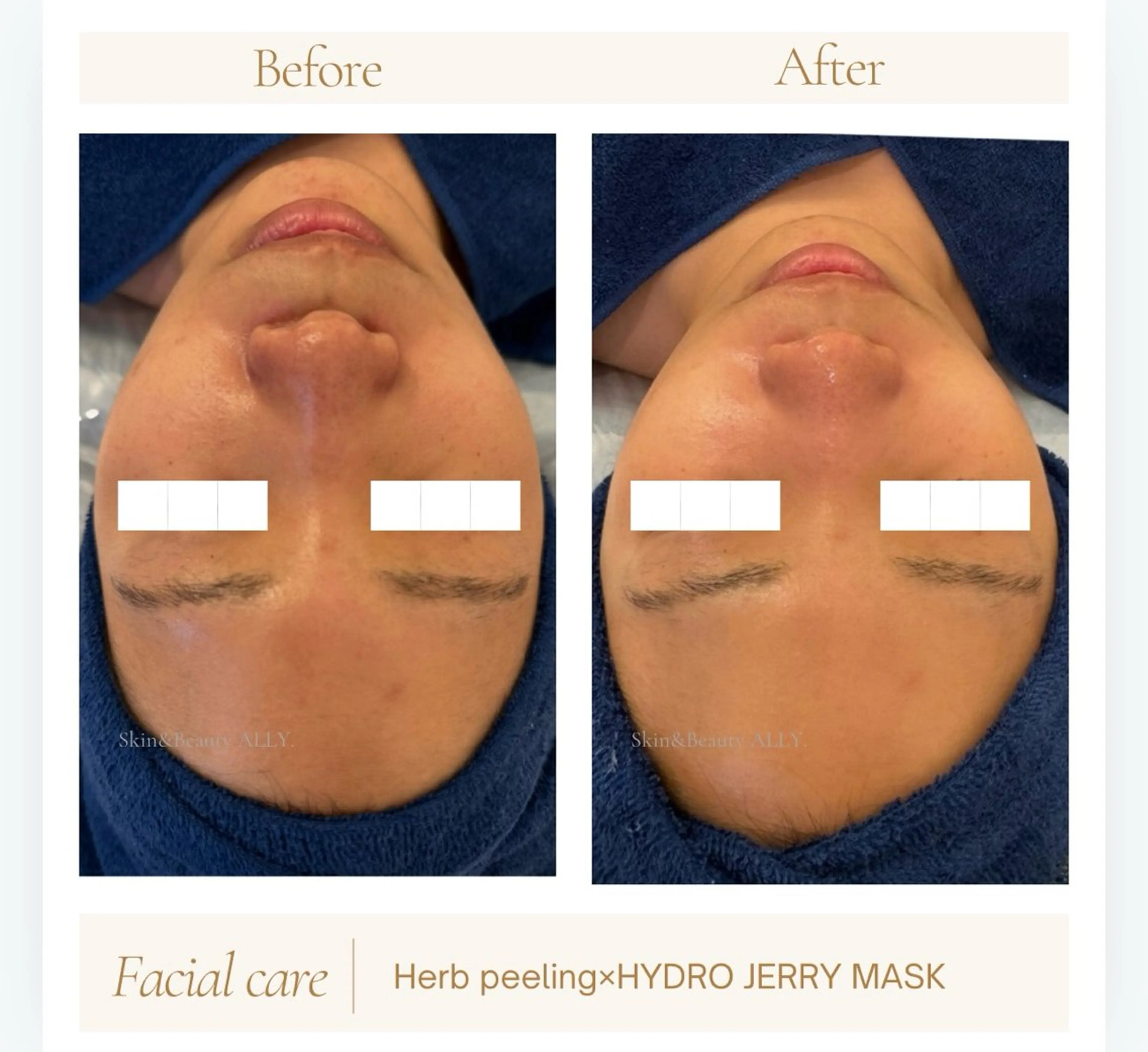 エステ 艶肌ワックス ALLY.のエステ・リラクイメージ