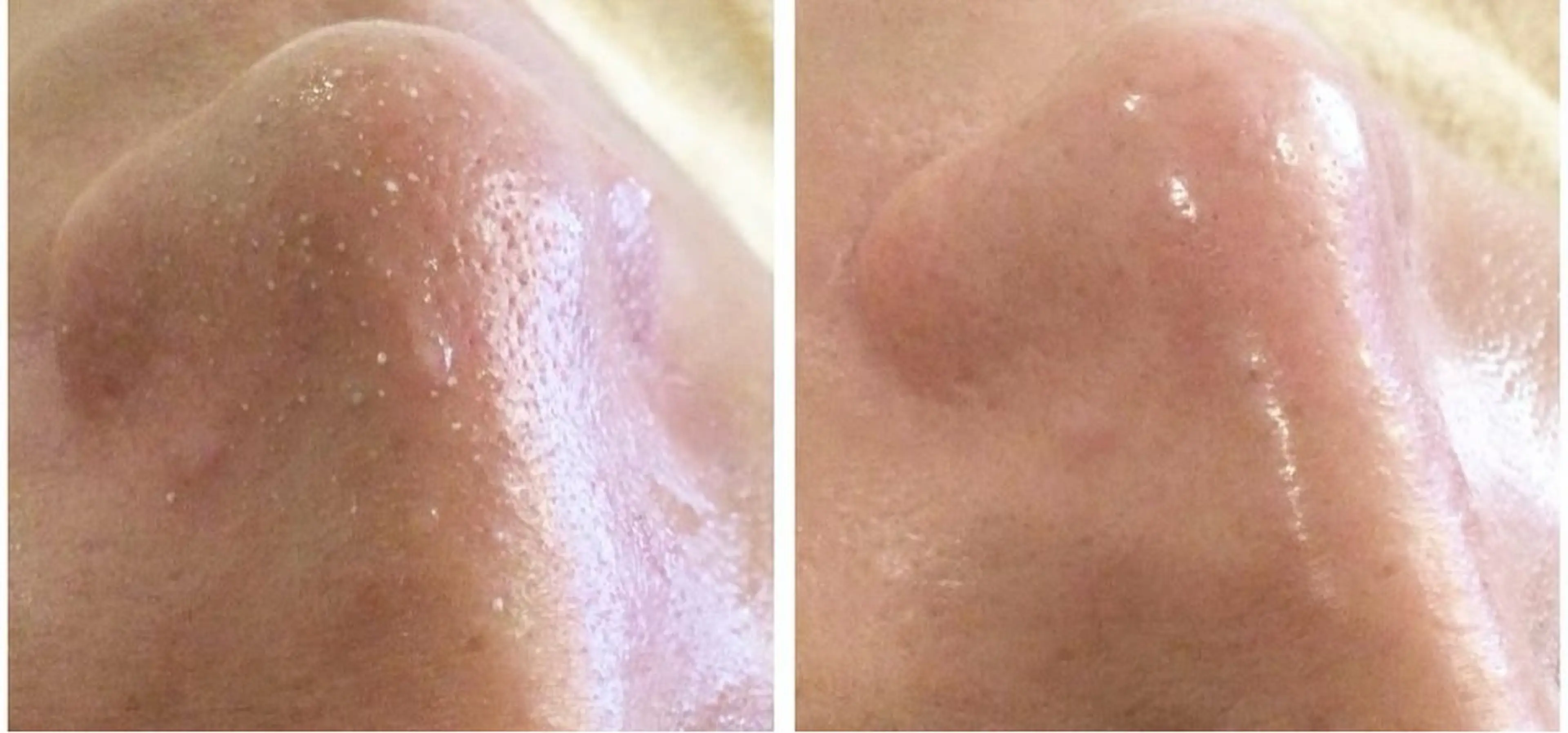 ナルシストータルビューティーサロン所属・友森 千香のエステ・リラクイメージ