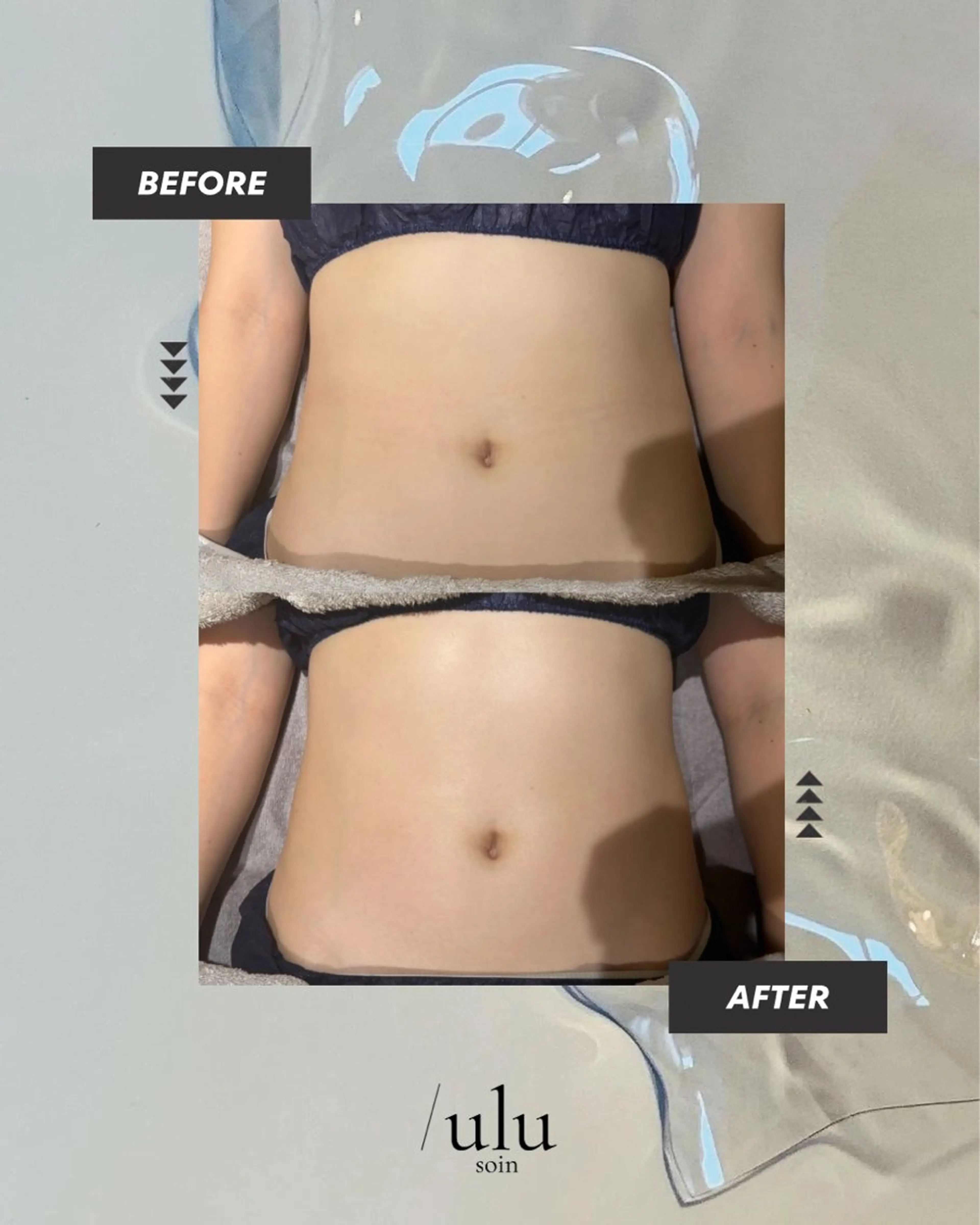 エステ /ulu  soin所属・太田 玲奈のエステ・リラクイメージ