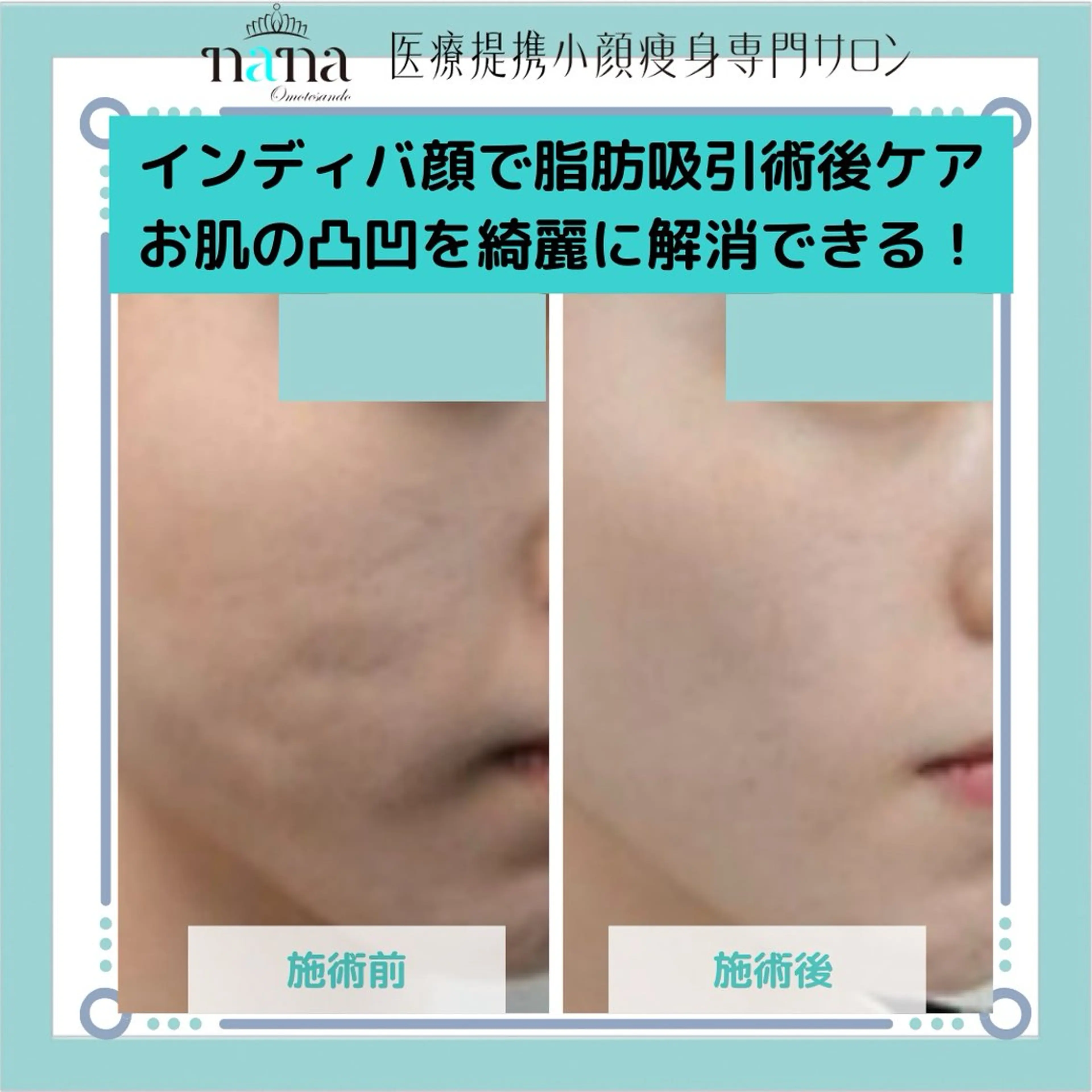 エステ リラク 小顔痩身インディバ Nana表参道のエステ・リラクイメージ
