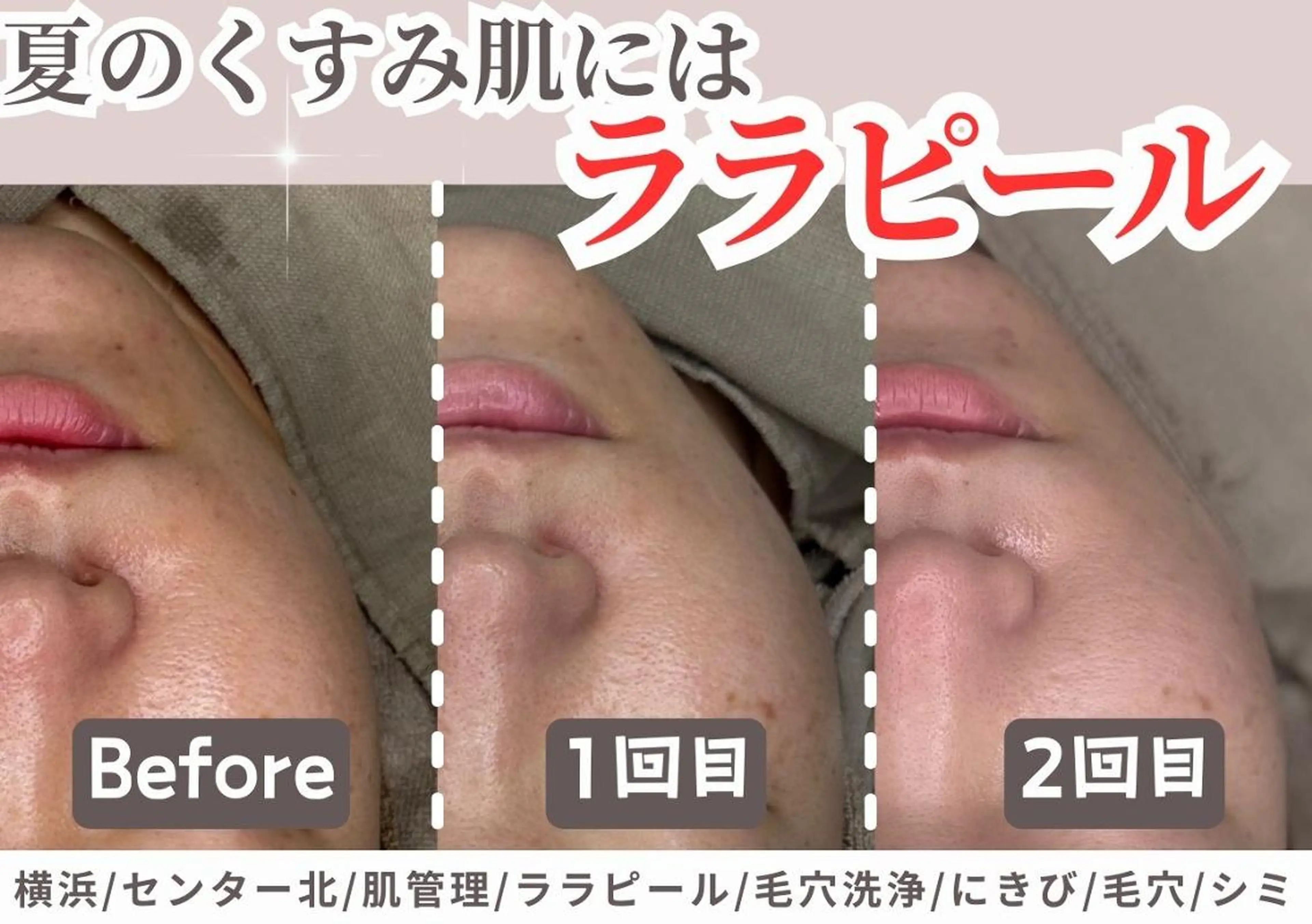 sii センター北 AIのエステ・リラクイメージ