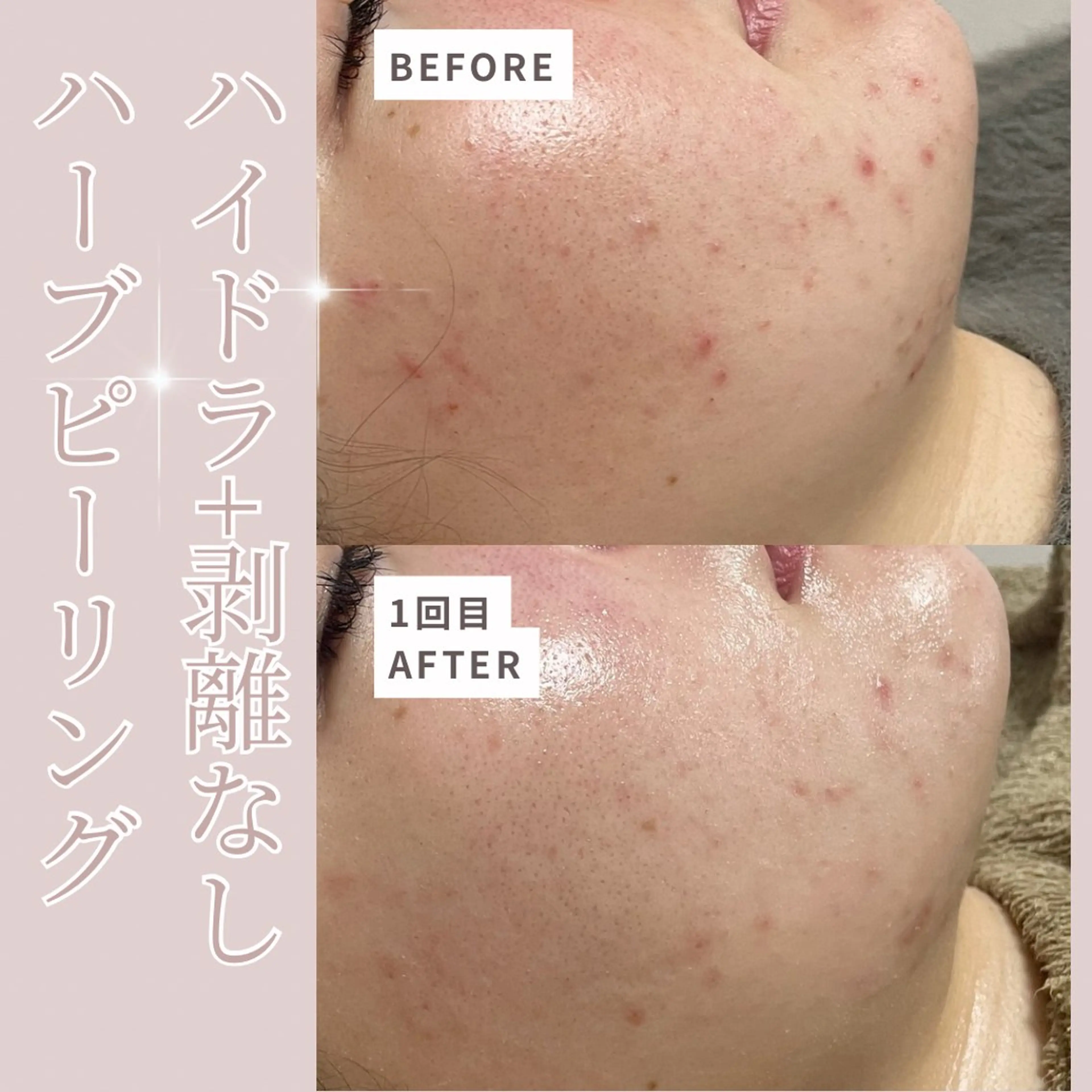 エステ プライベートサロン Belle(ベル)のエステ・リラクイメージ