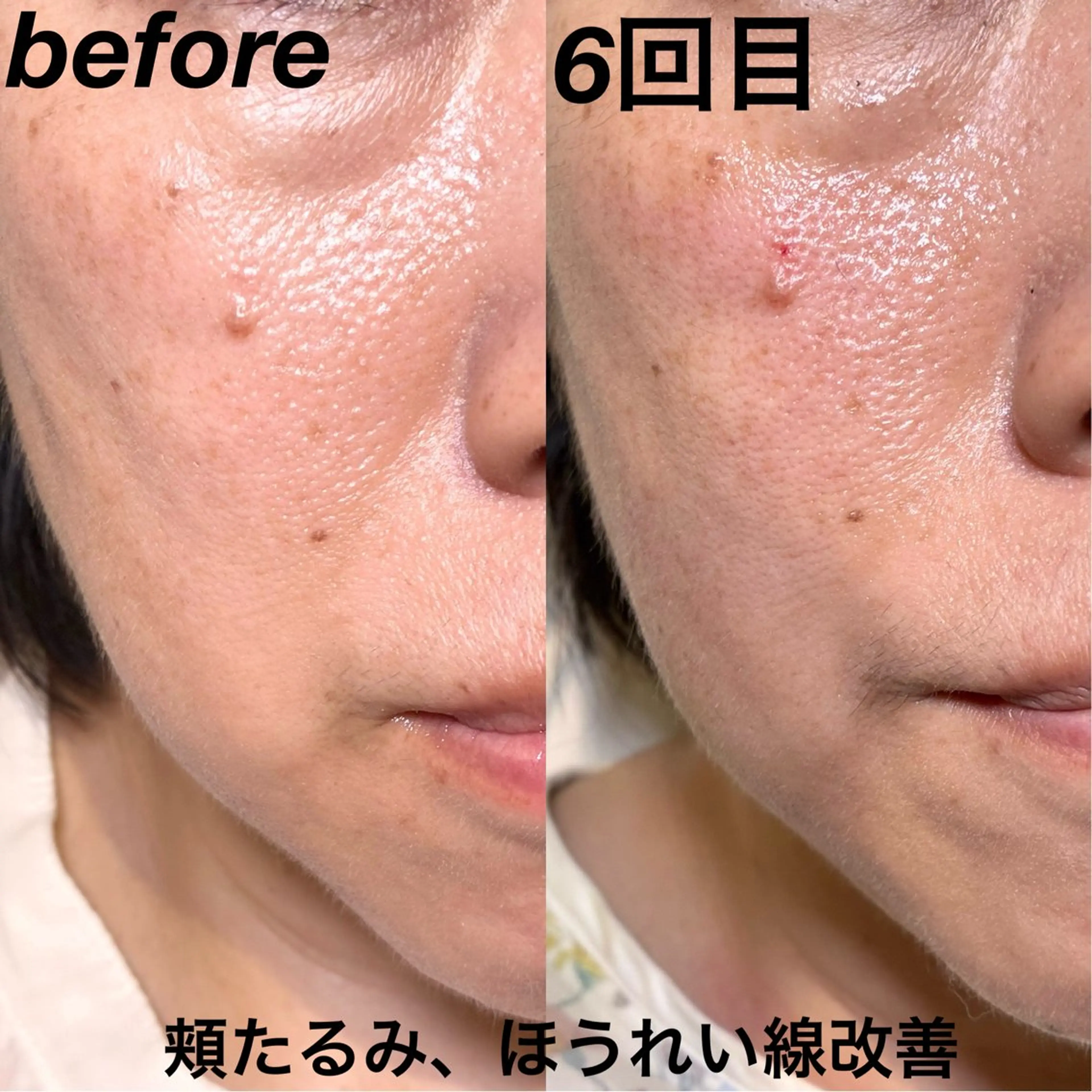 エステ リラク 経堂鍼灸整体院 古木のエステ・リラクイメージ