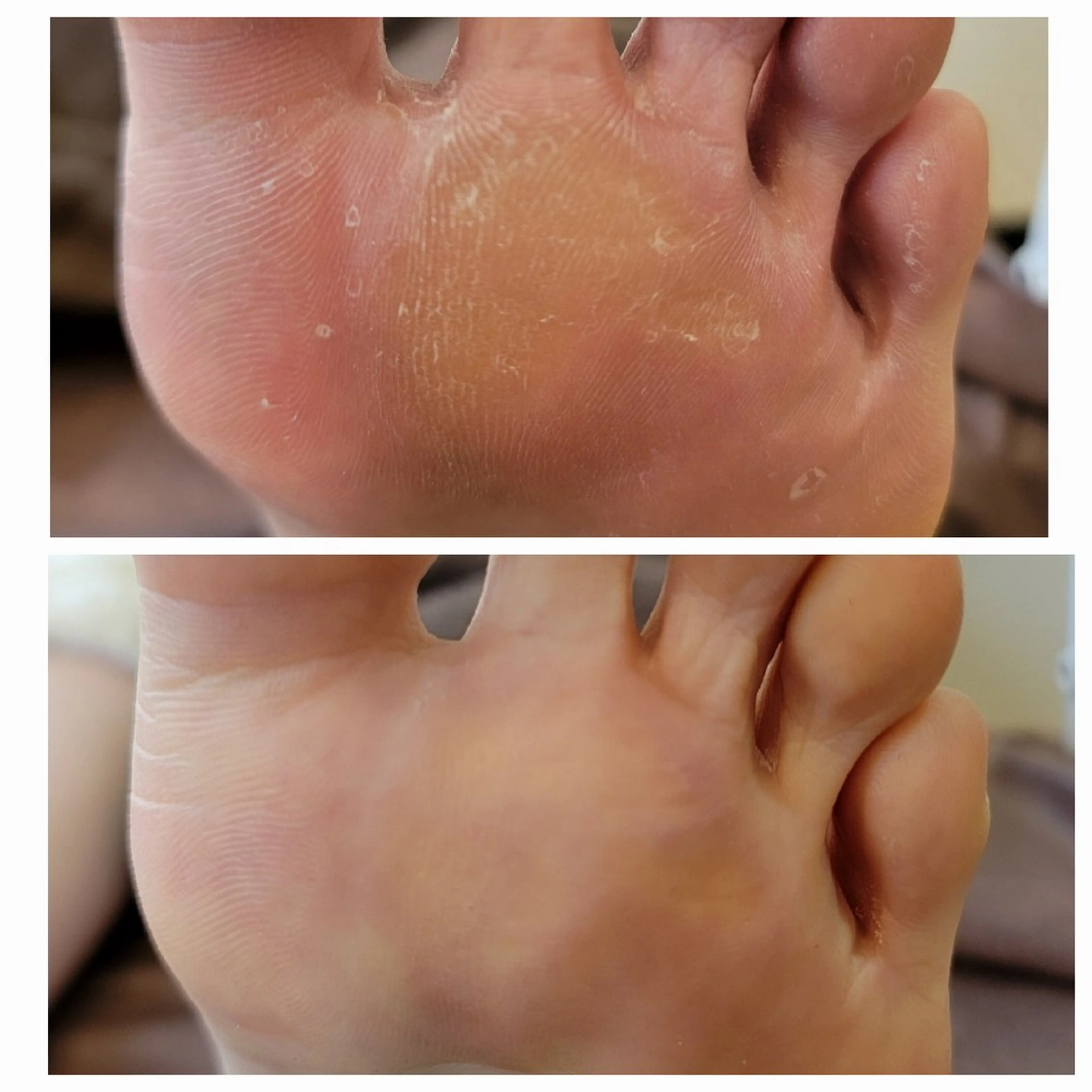 その他(ネイル) ネイル&巻き爪サロン 　AKnailのネイルデザイン