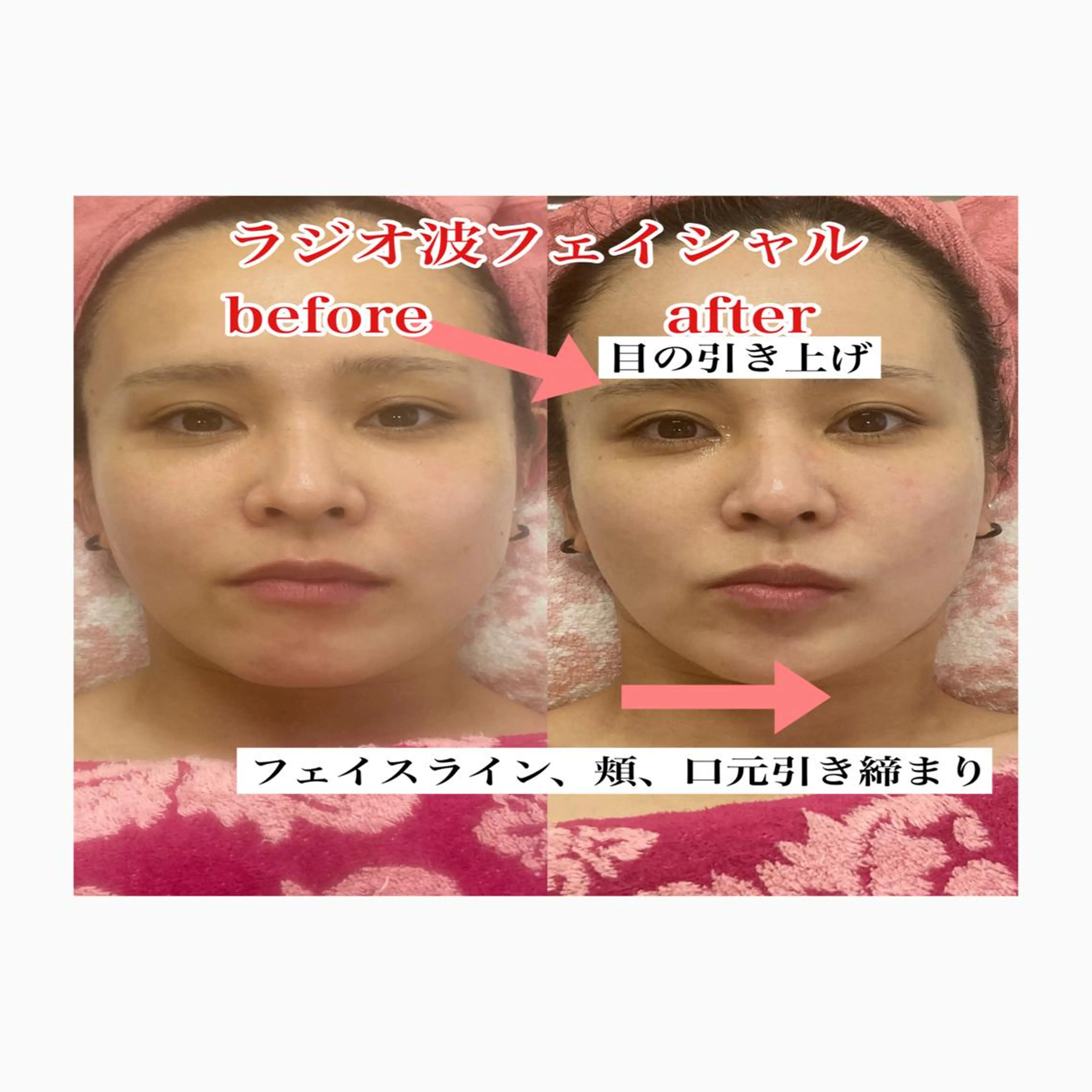 オアシス・さくら所属・中村貴子都度払い脱毛 小顔コルギのエステ・リラクイメージ
