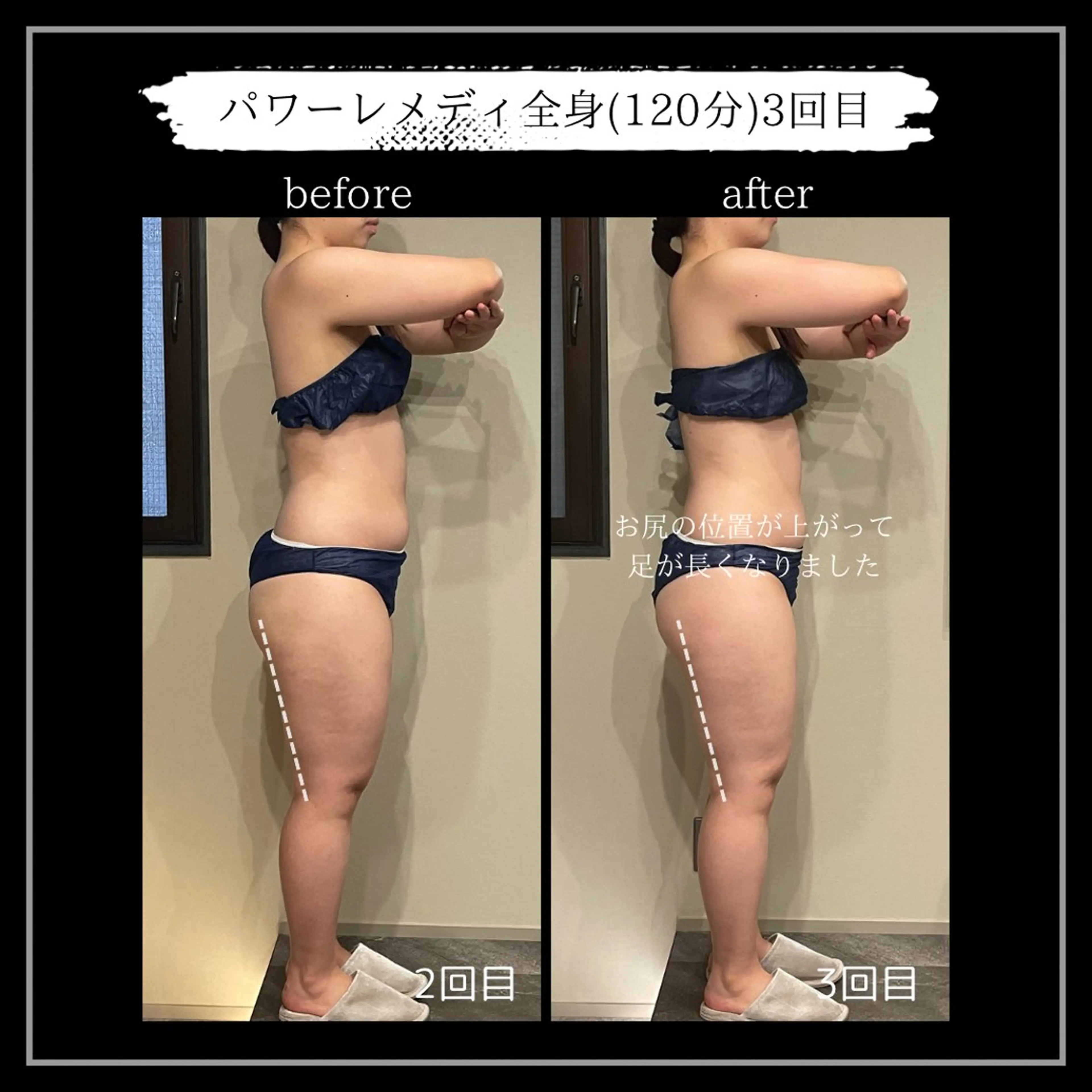 オフ:オン所属・オフ:オン 全身筋膜マッサージのエステ・リラクイメージ