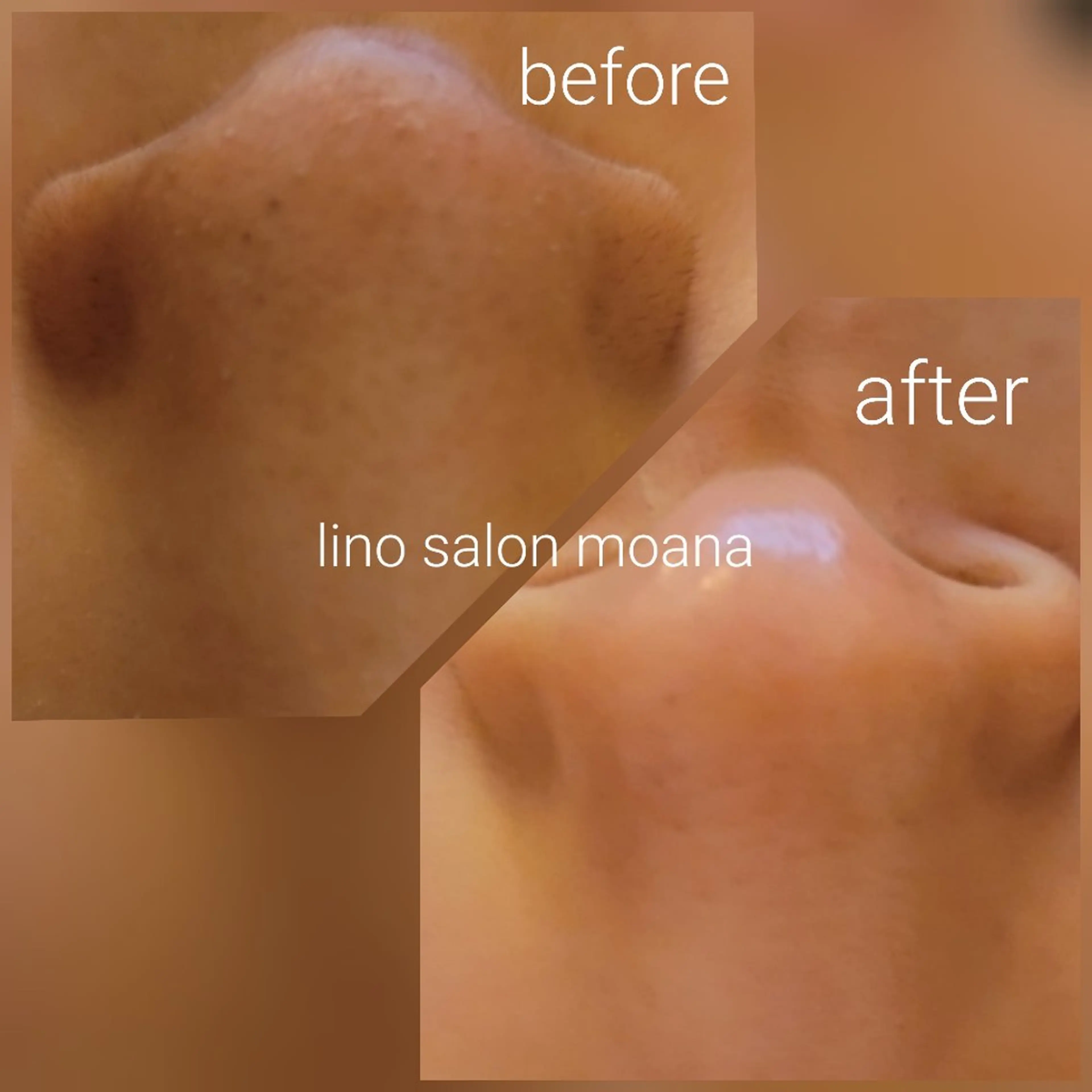 lino salon moana所属・lino salon  moanaのエステ・リラクイメージ