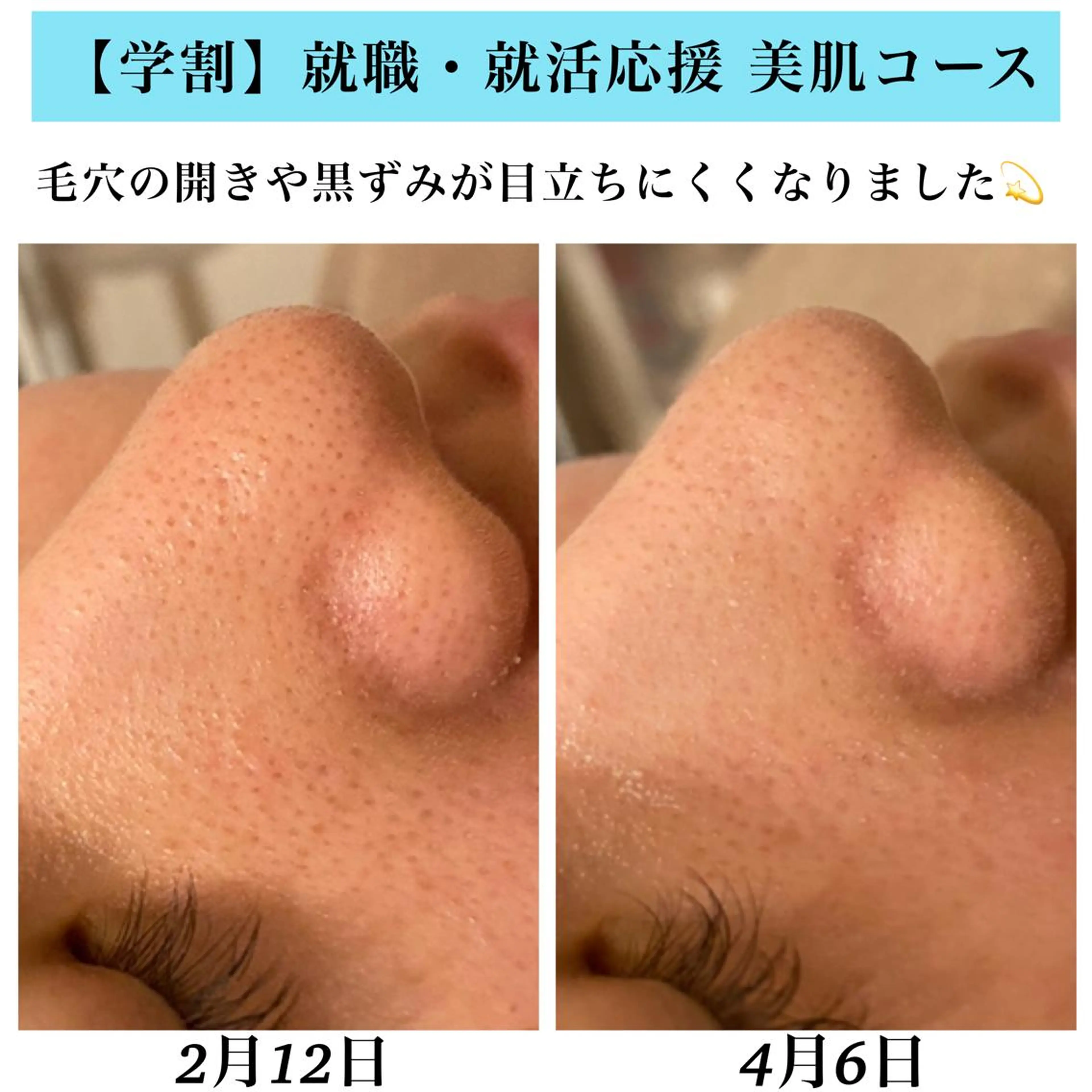 エステ Bellesthe （ベルエステ）のエステ・リラクイメージ