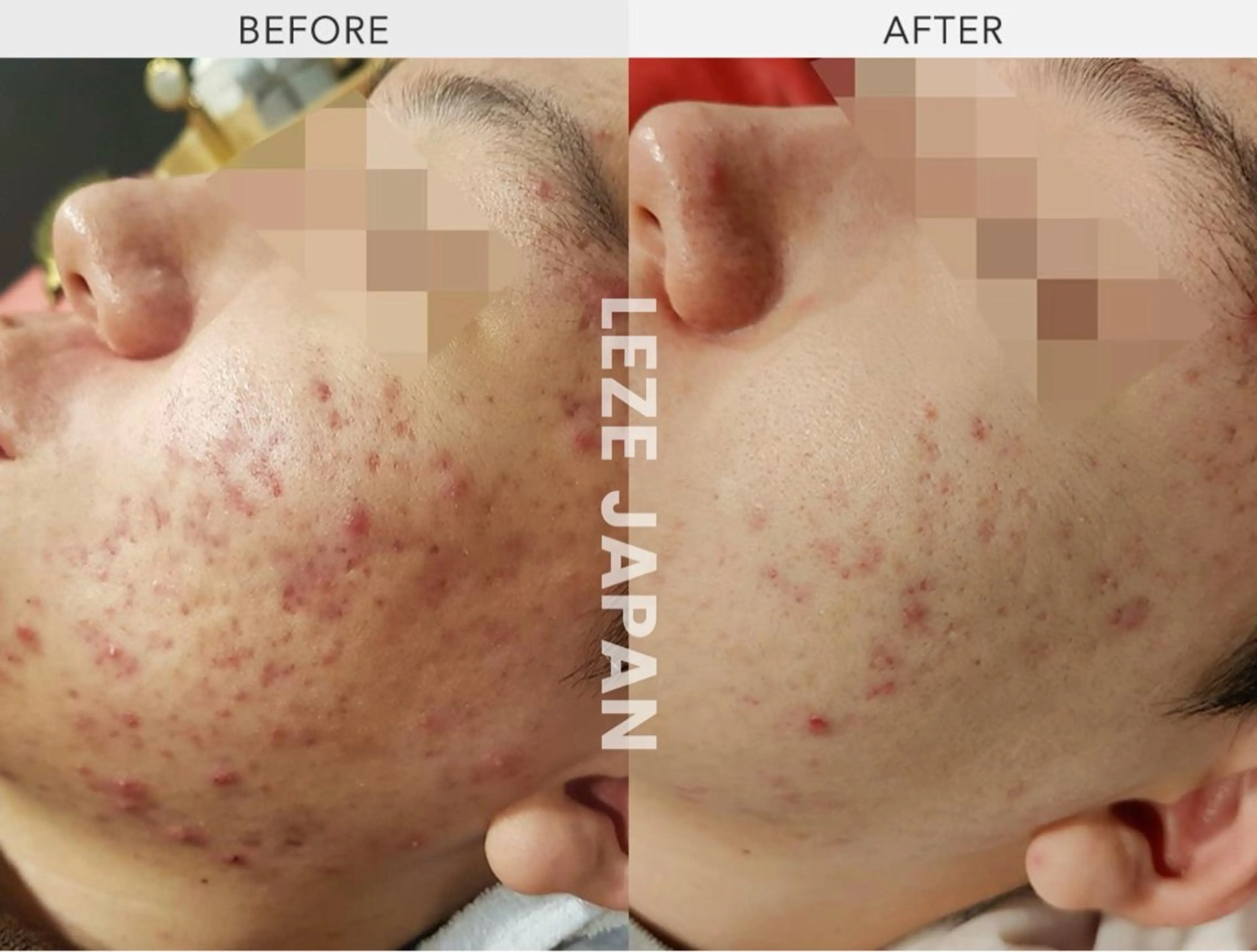 LA CLARTE所属・LA CLARTEのエステ・リラクイメージ