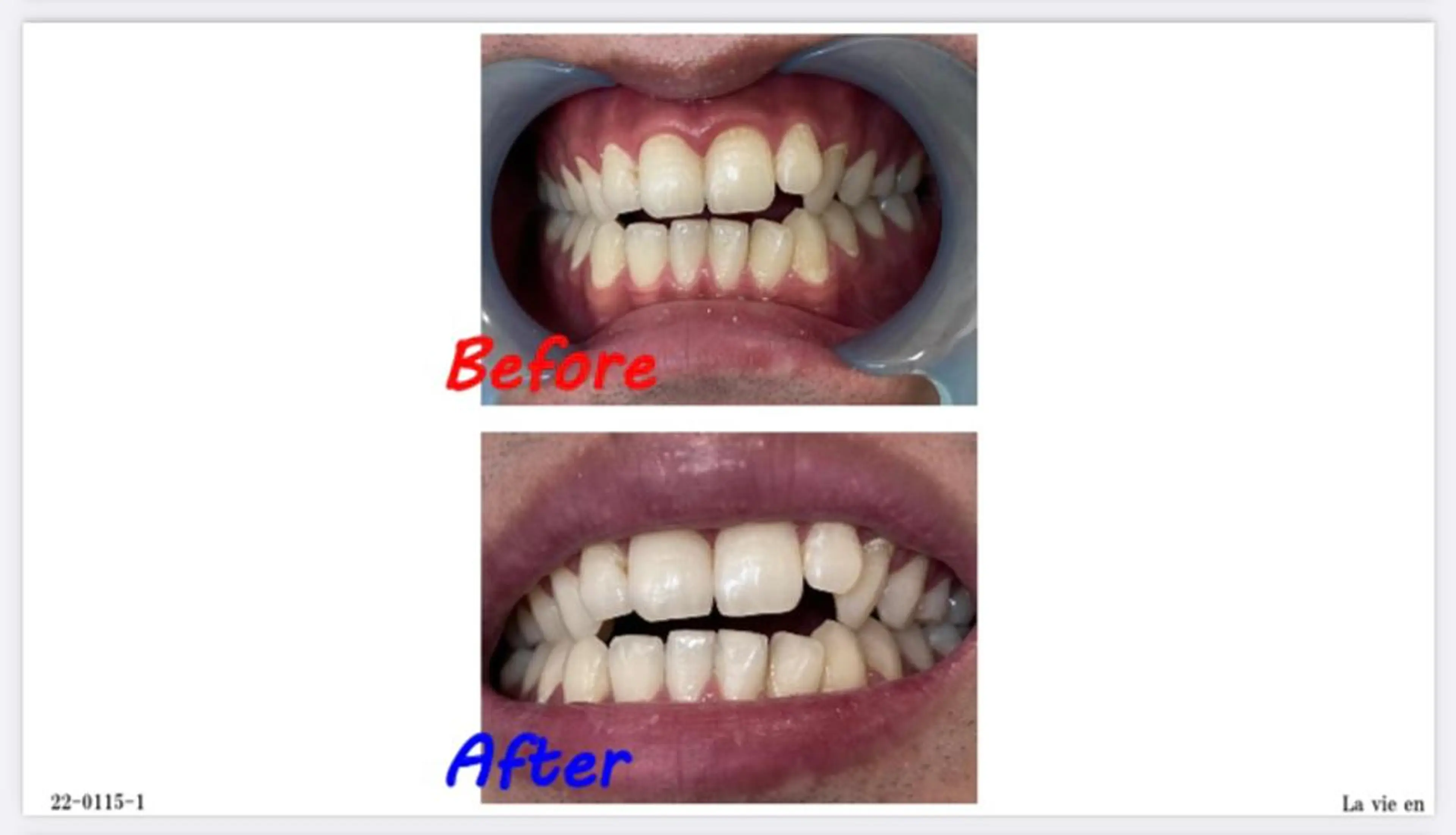 その他 セルフホワイトニングサロン　ラヴィアン所属・ホワイトニングサロン La vie enのその他イメージ