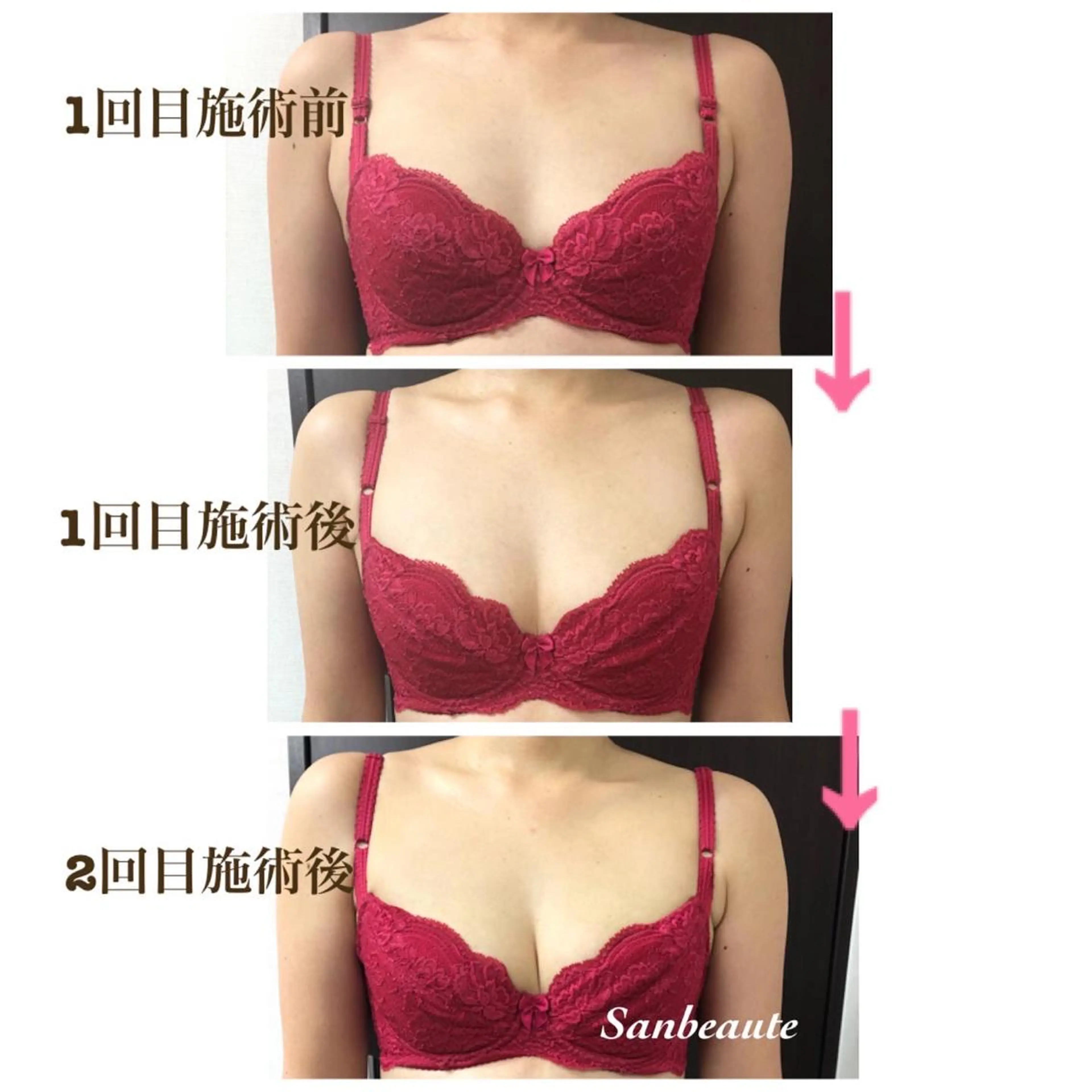 エステ Sanbeaute サンボーテのエステ・リラクイメージ