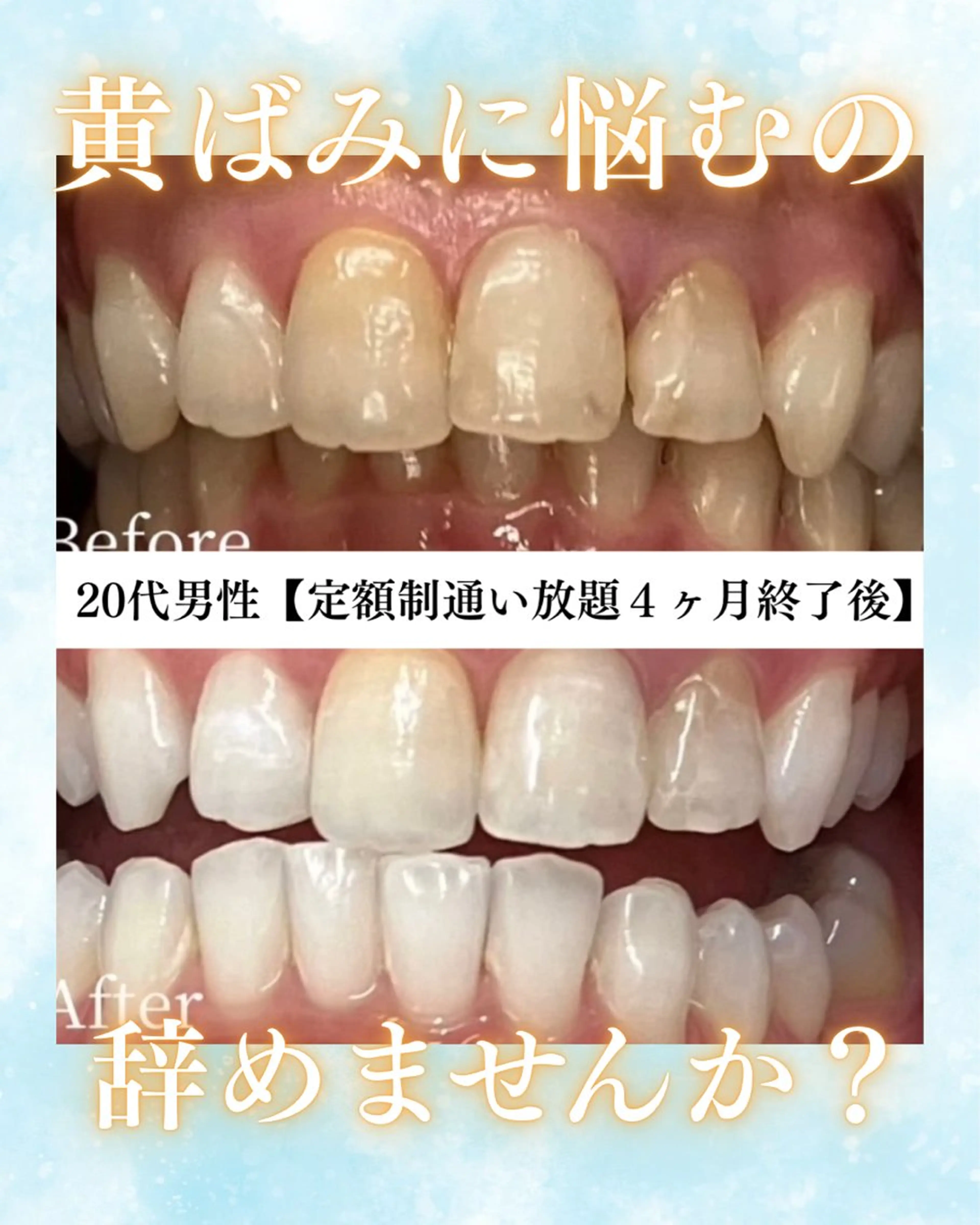 メンズ キッズ エステ リラク ホワイトニング専門店 WHITE天神店のエステ・リラクイメージ