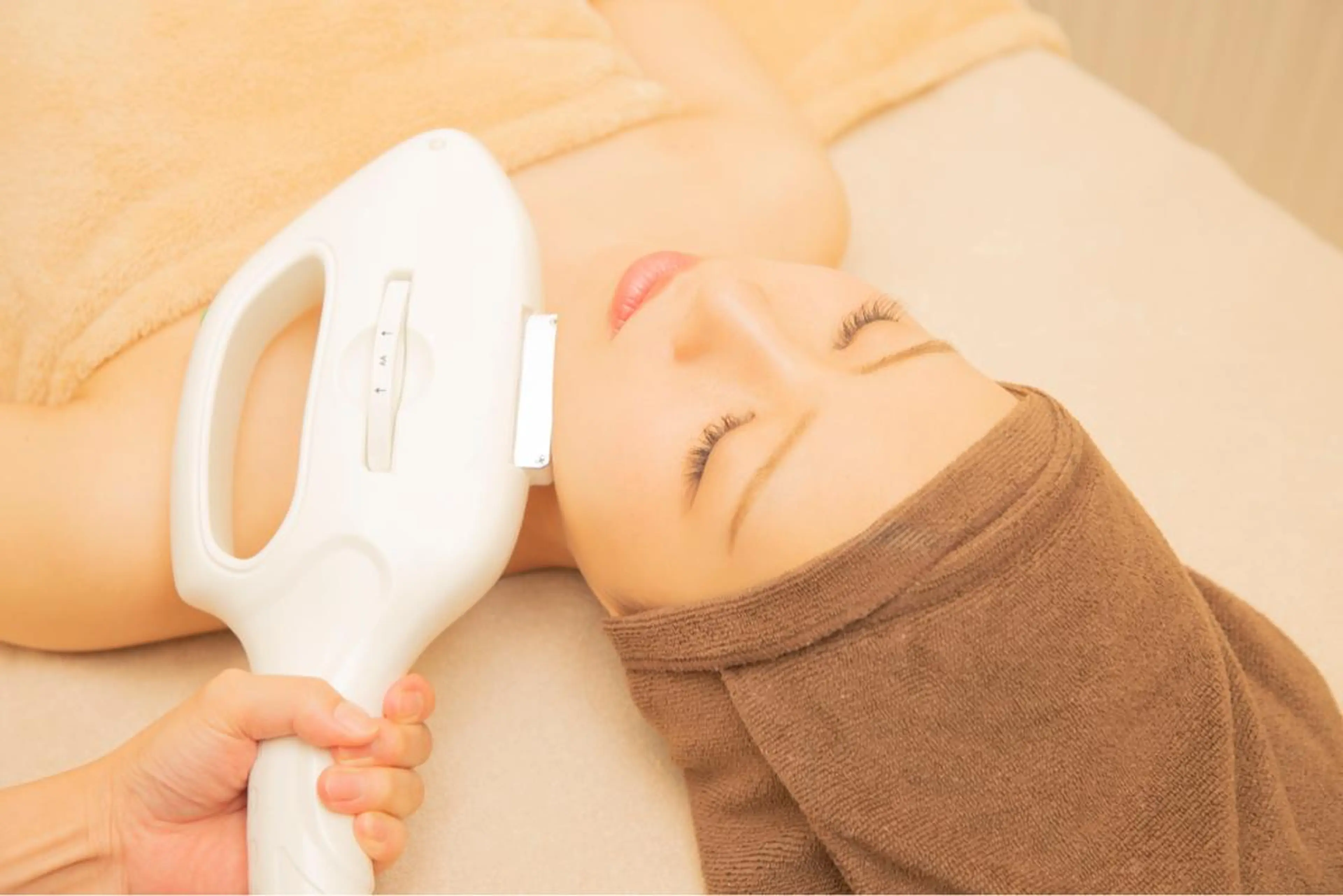 4月限定　【美肌もちもちお肌✨】　顔脱毛の写真