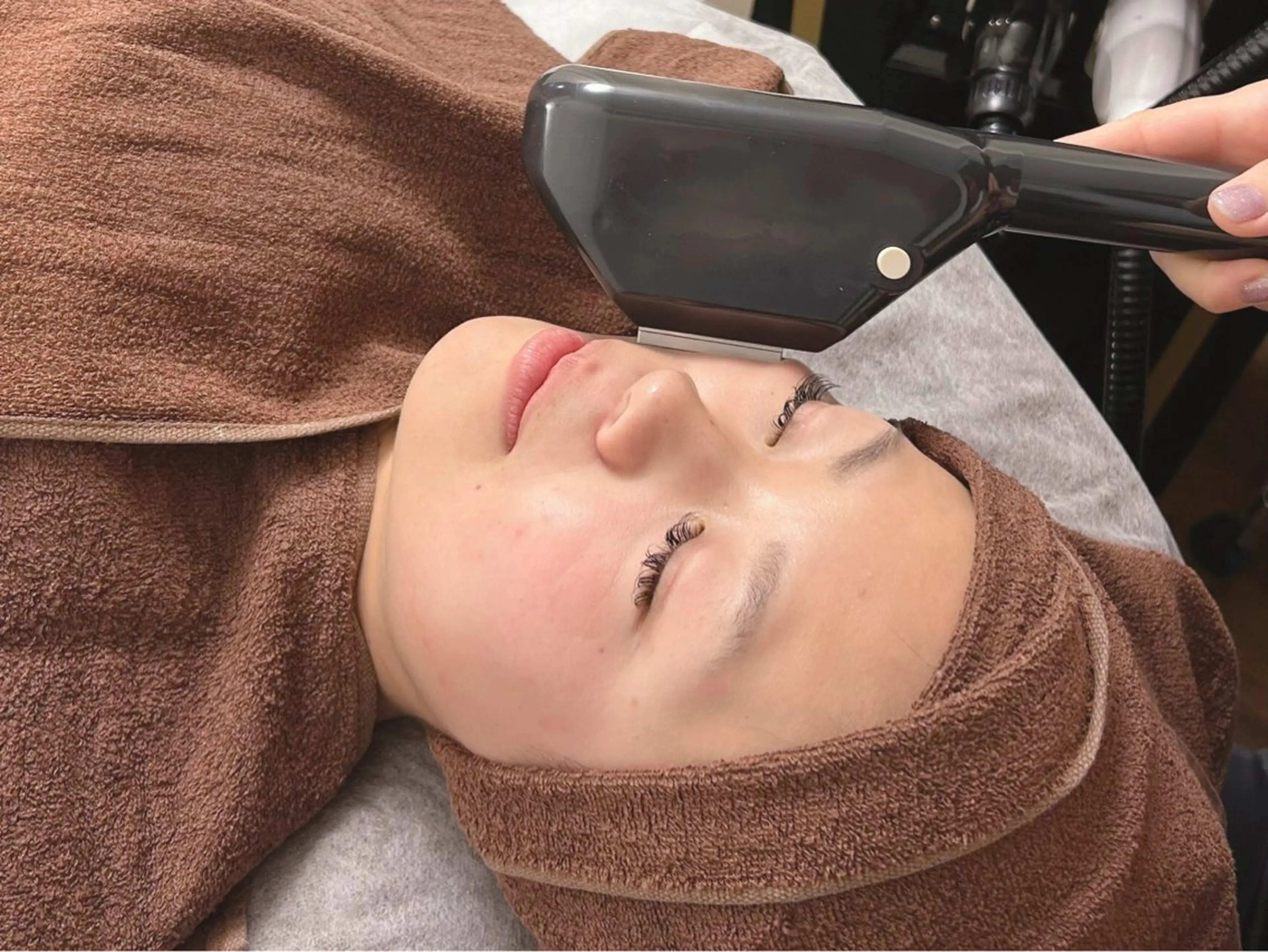 【レディース限定】オリジナルの細かい照射で気になる産毛にもしっかり効果を発揮☆顔全体脱毛1回通常¥6600→￥3980の写真