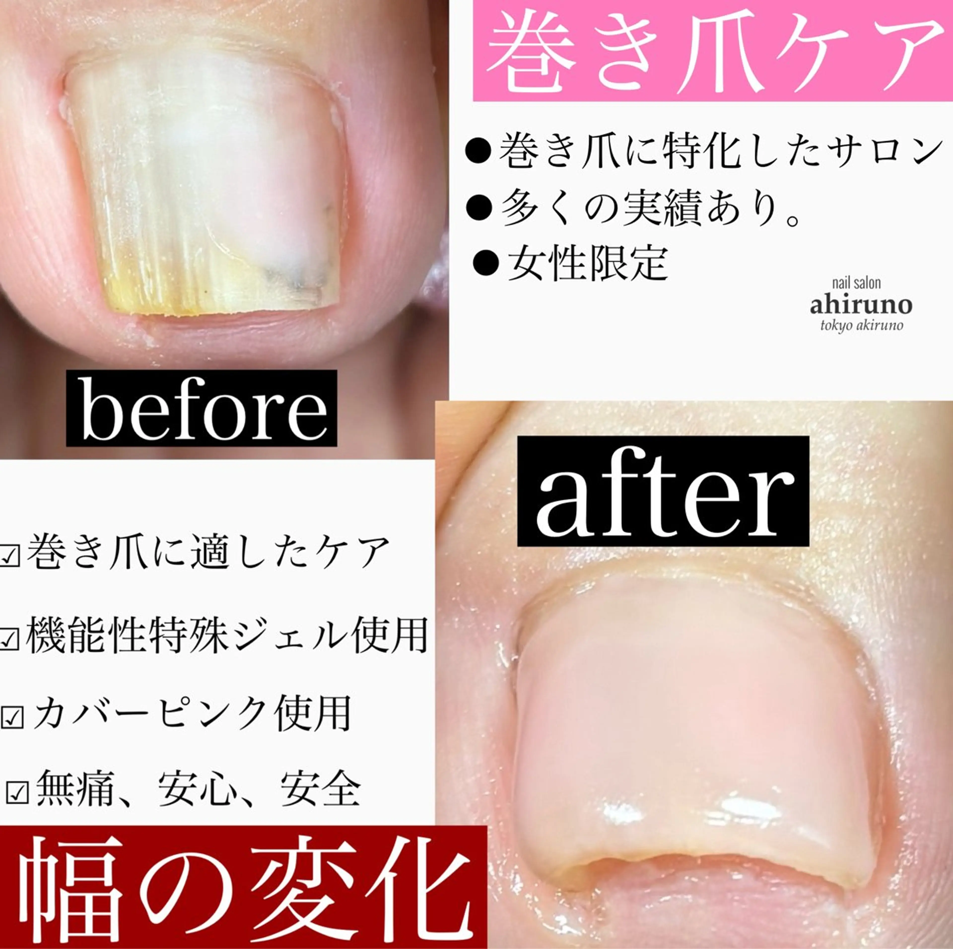 フットネイル ａｈｉｒｕｎｏ ✿ ｙｕiのネイルデザイン