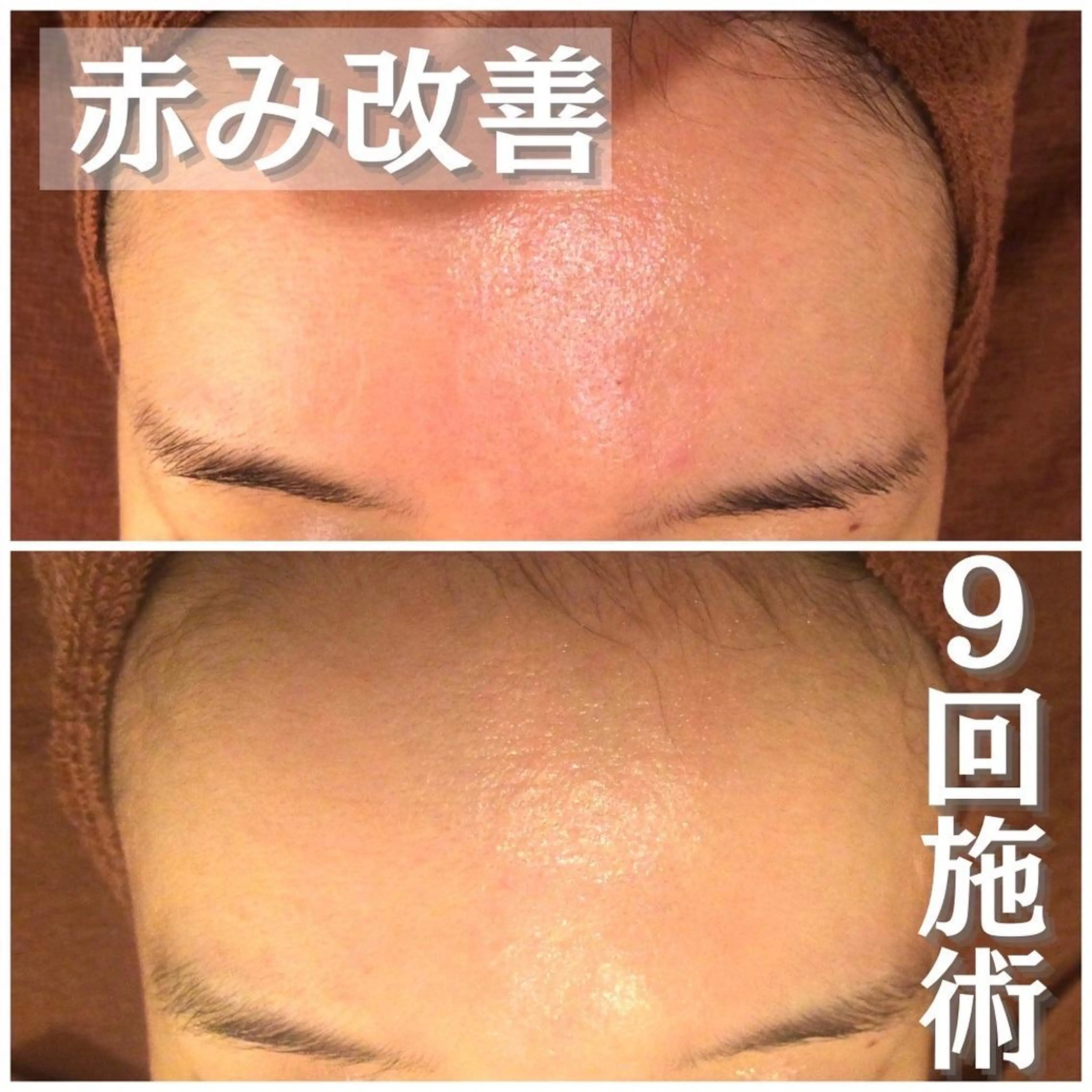 ミディアム カラー パーマ ヘアアレンジ メンズ キッズ ネイル マツエク・マツパ アイブロウ 赤色 エステ リラク アクール　齋藤 ♡肌トラブル卒業のエステ・リラクイメージ