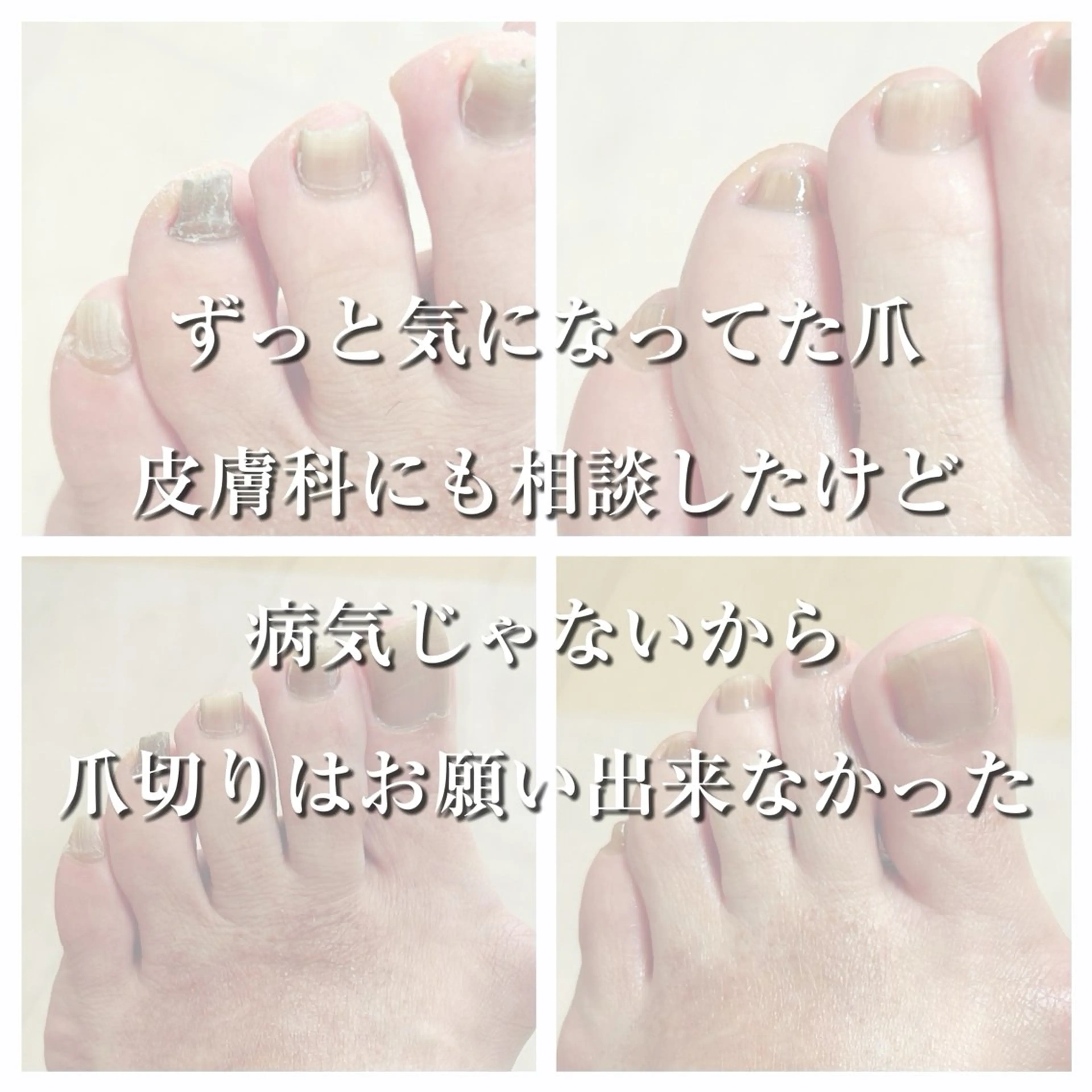 その他 巻き爪フットケアサロンKotori所属・フットケアサロン Kotoriのその他イメージ