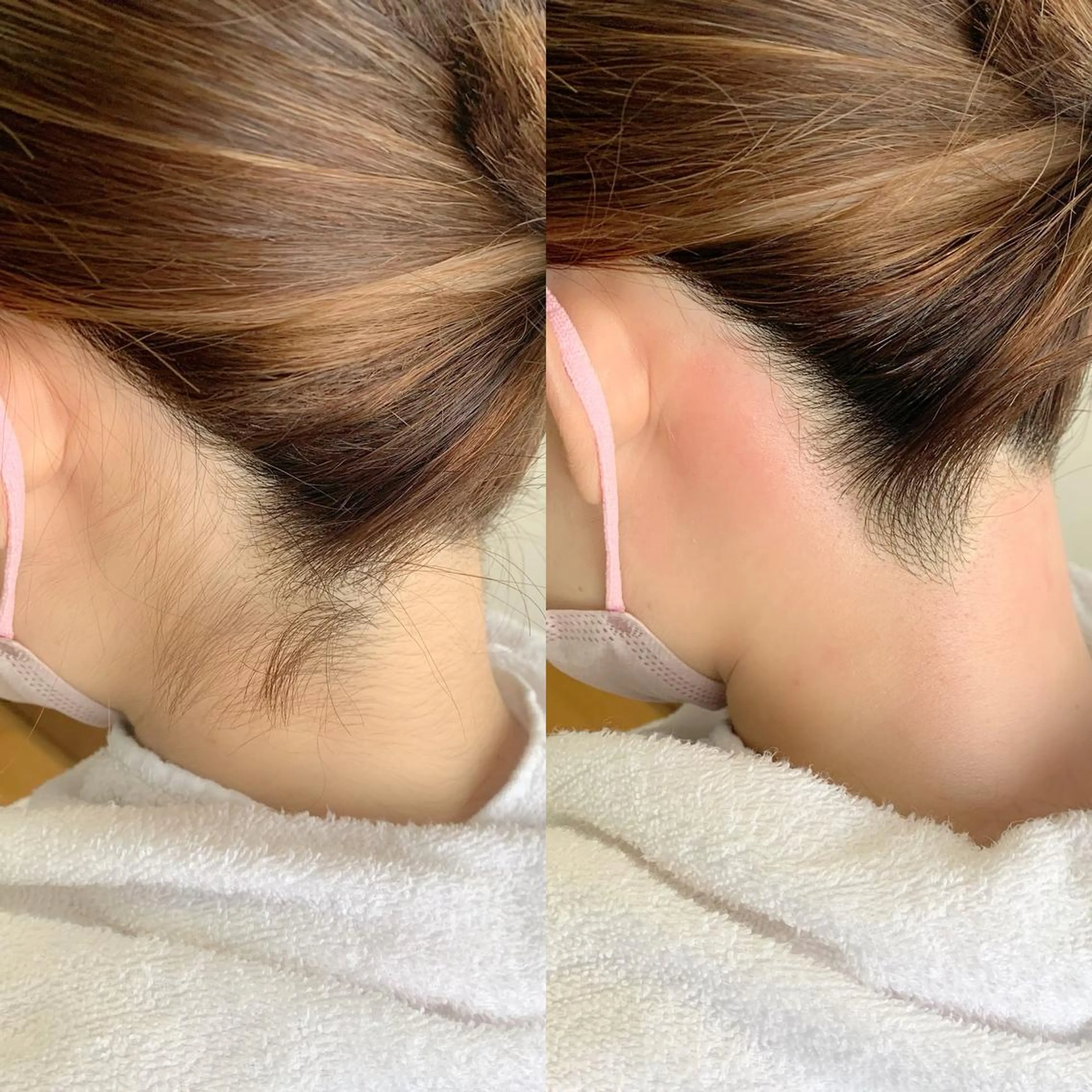 脱毛 salonLADYSTYLE所属・稲嶺 美華のエステ・リラクイメージ