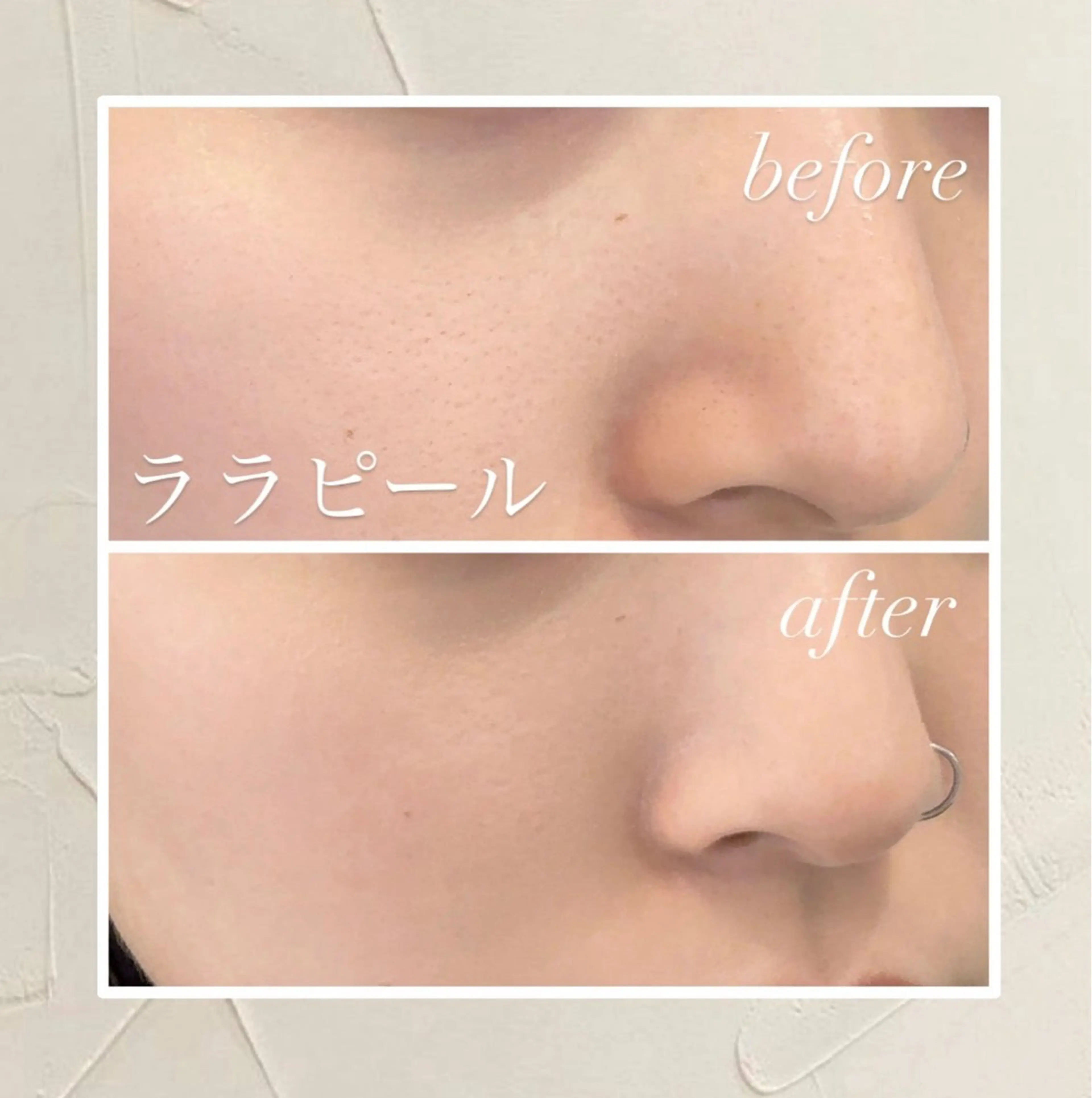 🦋肌質改善サロン. maho🦋のエステ・リラクイメージ