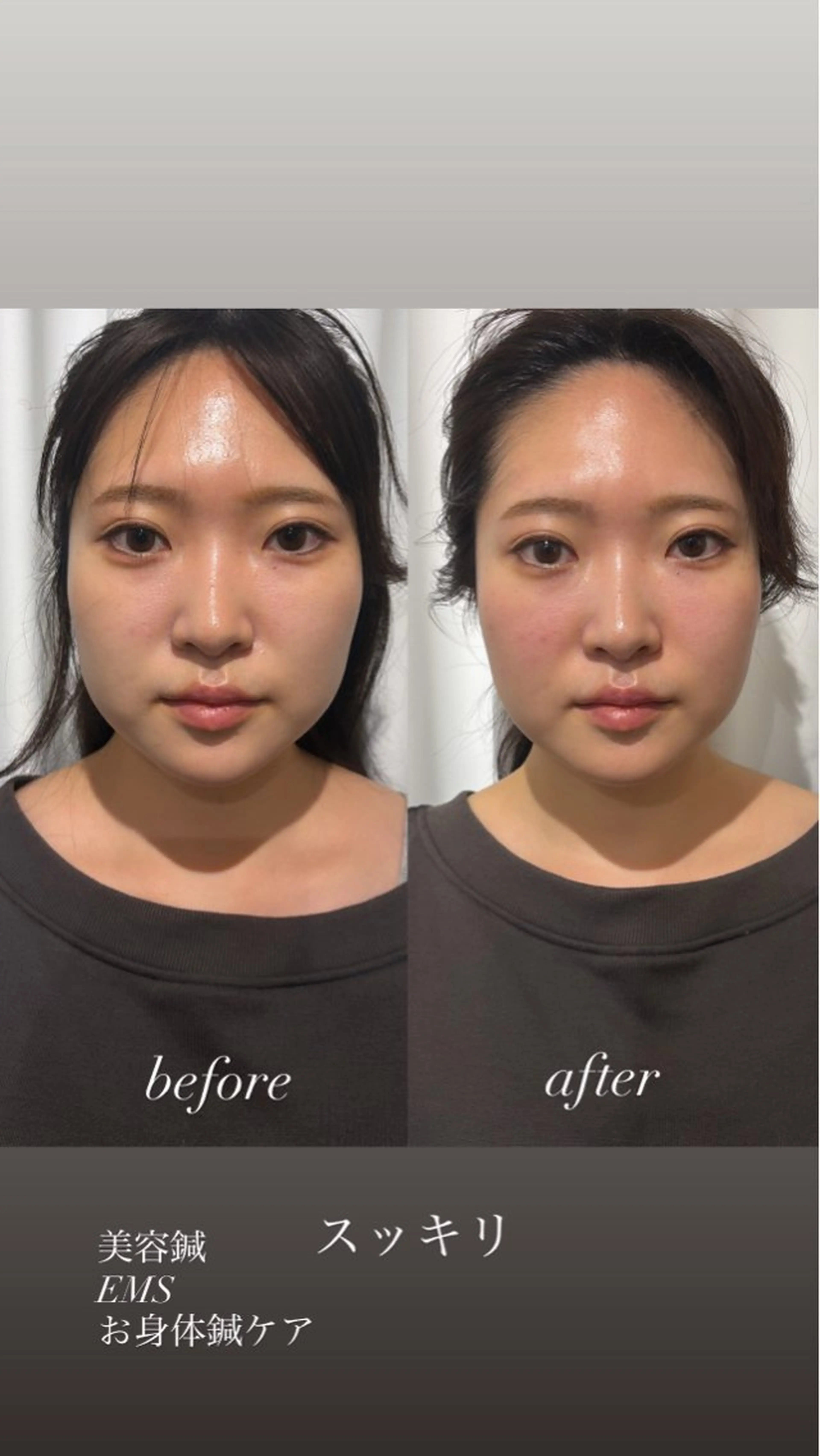 エステ リラク 美容鍼灸サロン mahoroba院長のエステ・リラクイメージ