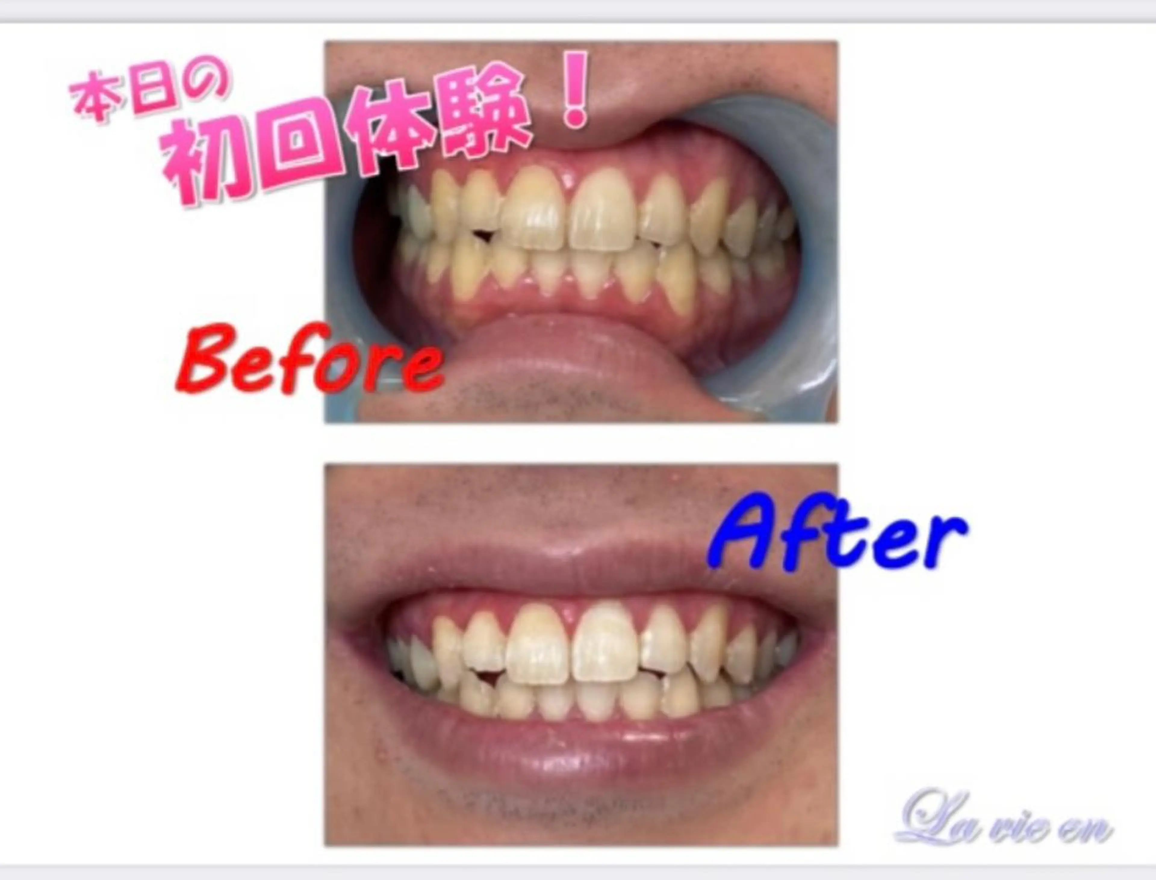 その他 セルフホワイトニングサロン　ラヴィアン所属・ホワイトニングサロン La vie enのその他イメージ