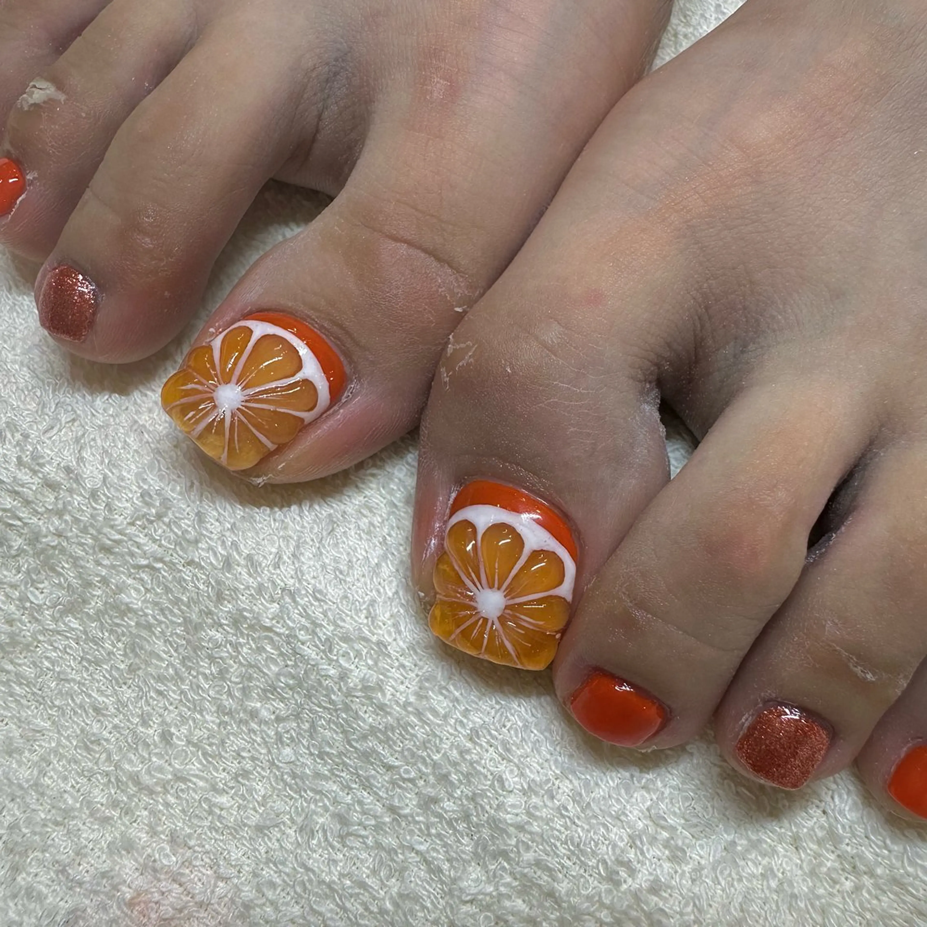 【FOOT】持ち込みデザイン　10本やり放題+指定パーツつけ放題　¥13000の写真