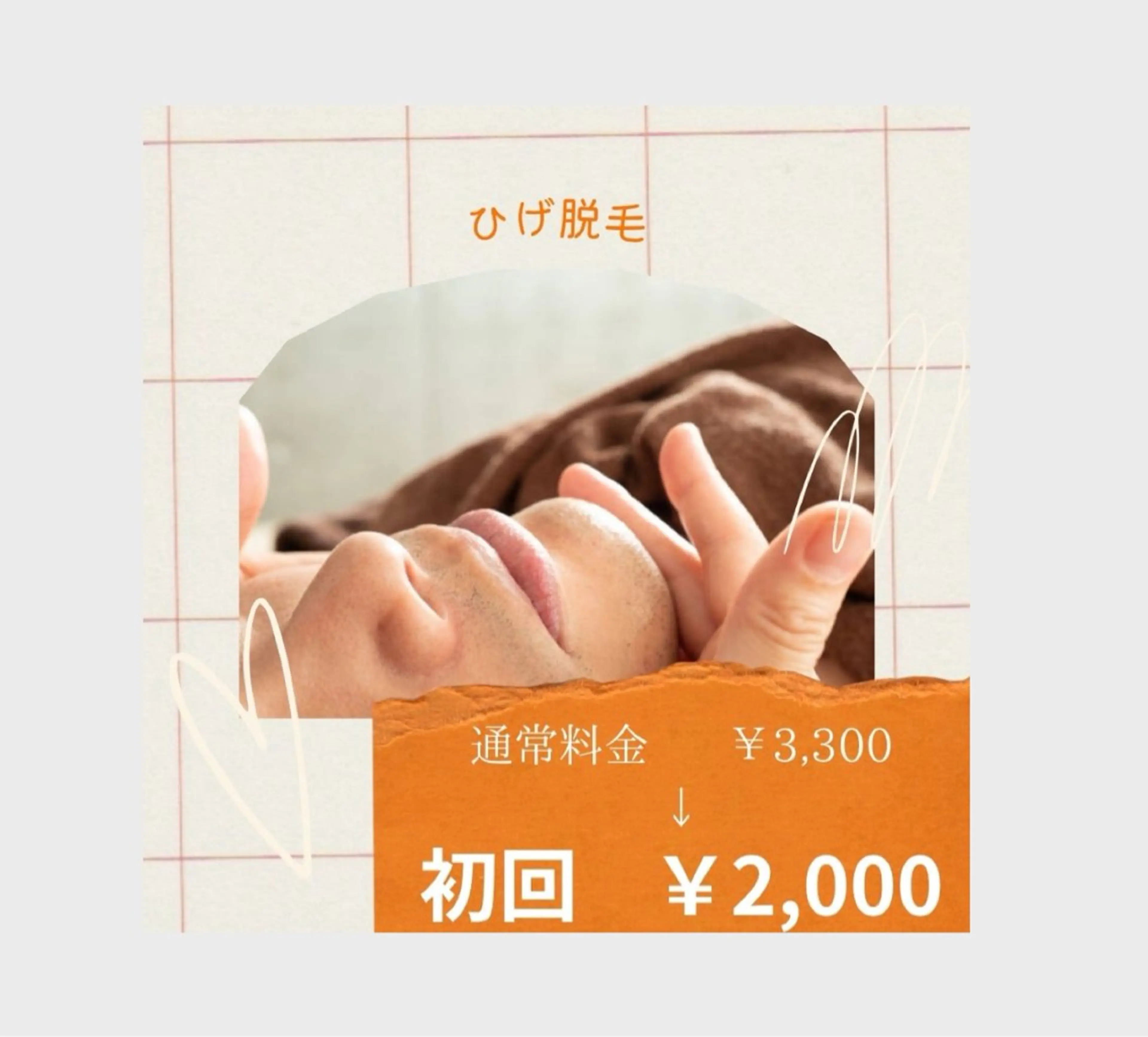 《清潔感·印象up♪》メンズひげ脱毛  初回30分の写真
