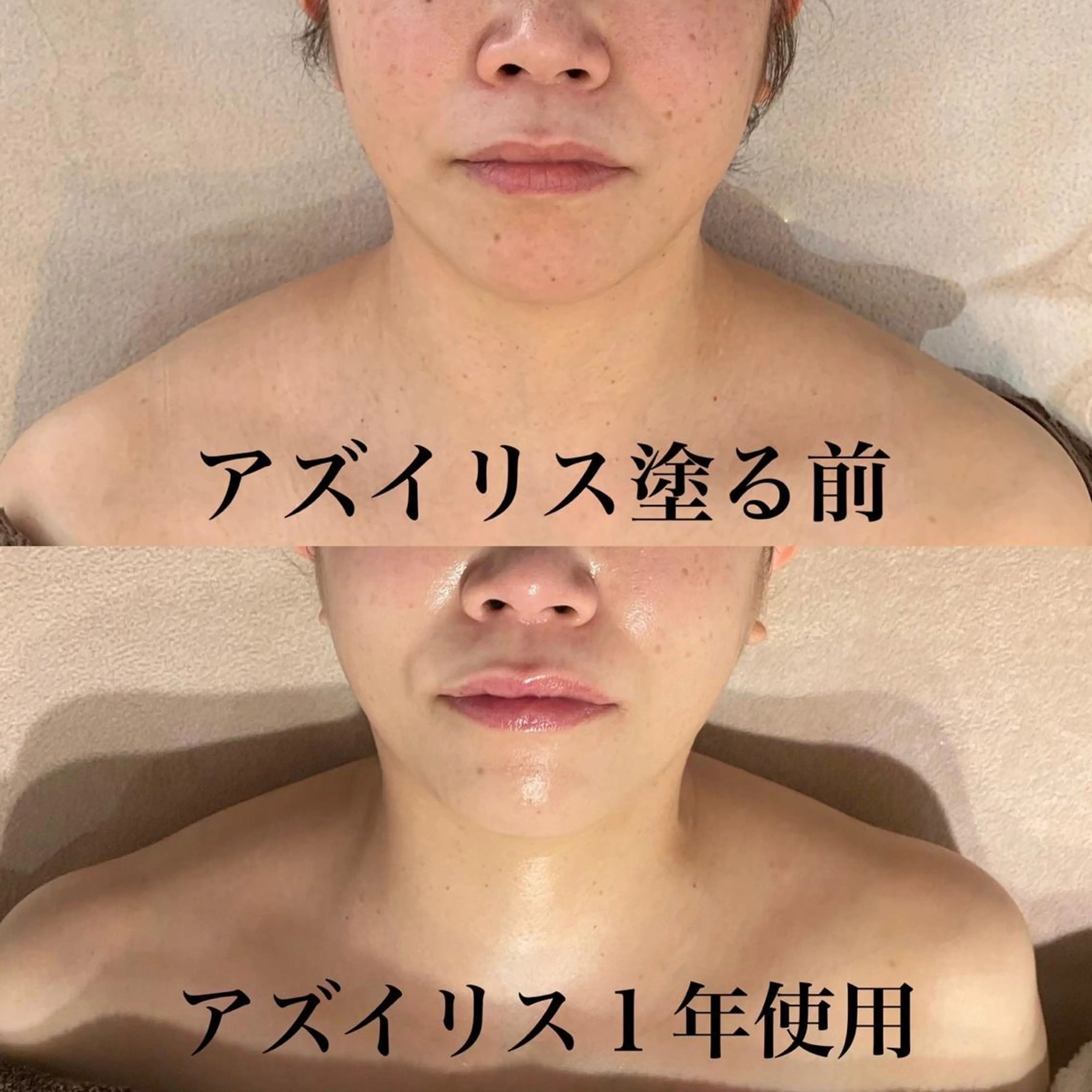 private salon Dea_maris シュガーリング&パーソナルボディケア所属・シミ改善・韓国肌管理 ボディメイク痩身のその他イメージ