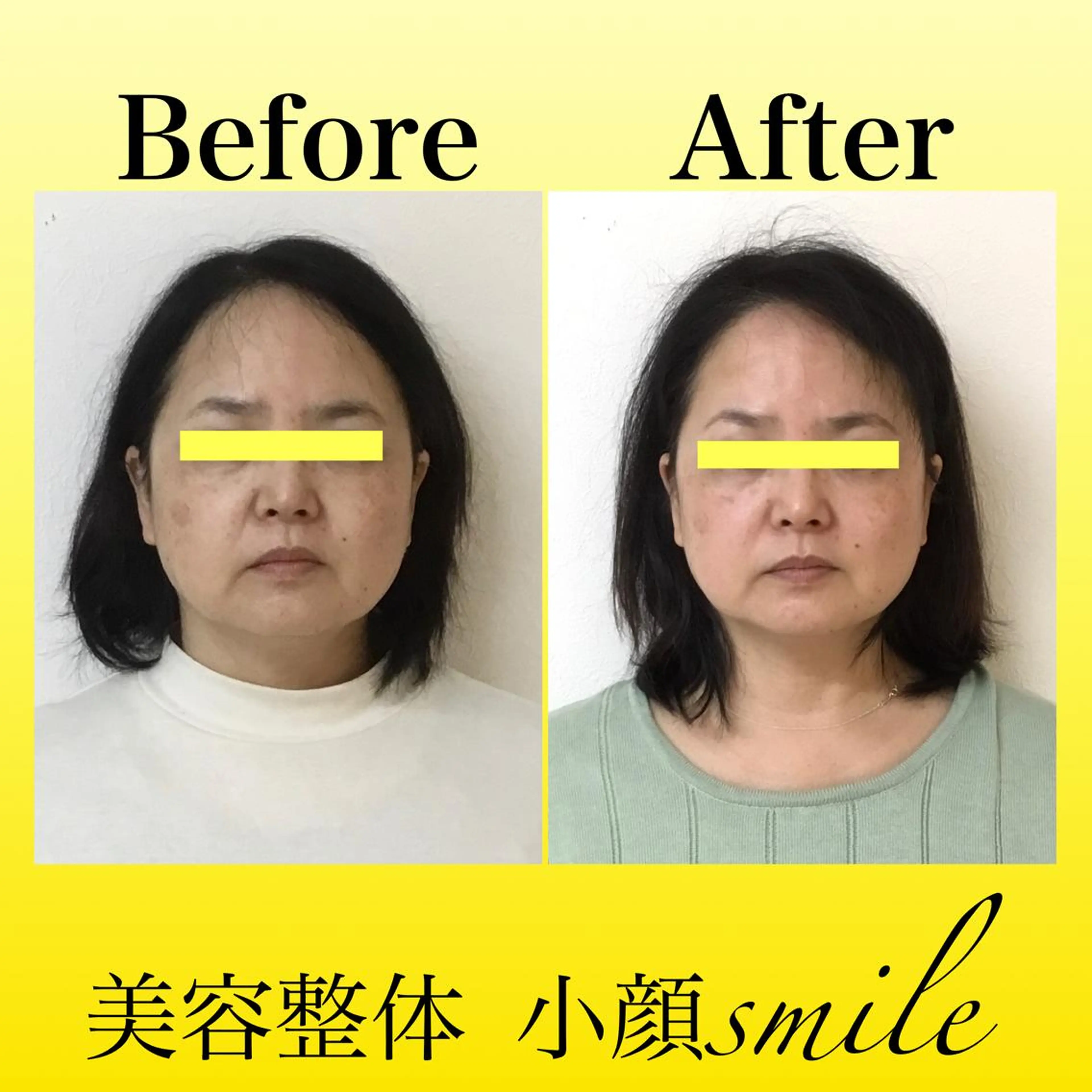 エステ リラク 【小顔・姿勢矯正】 美容整体 SMILEのエステ・リラクイメージ