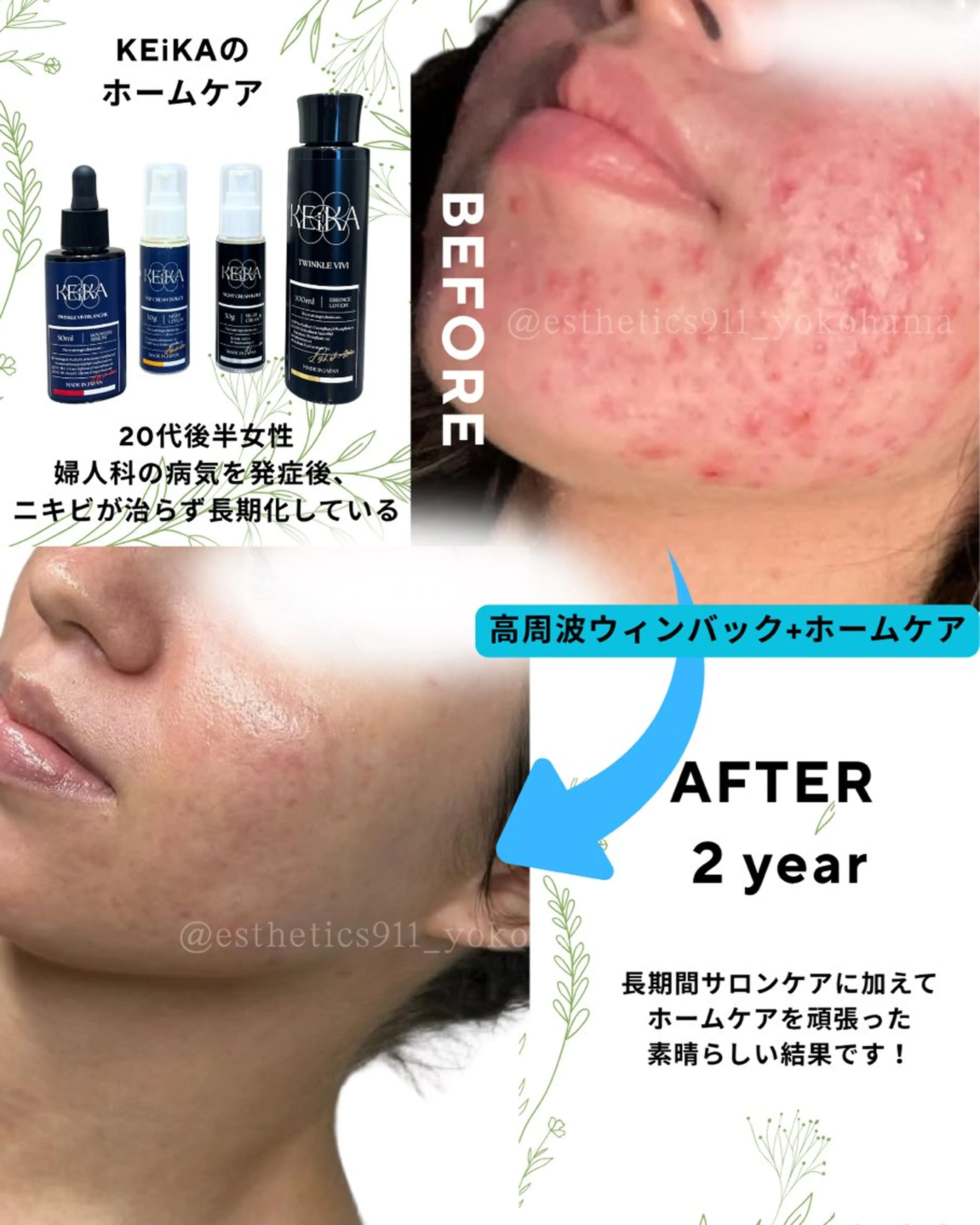 エステ リラク Esthetics 911横浜のエステ・リラクイメージ