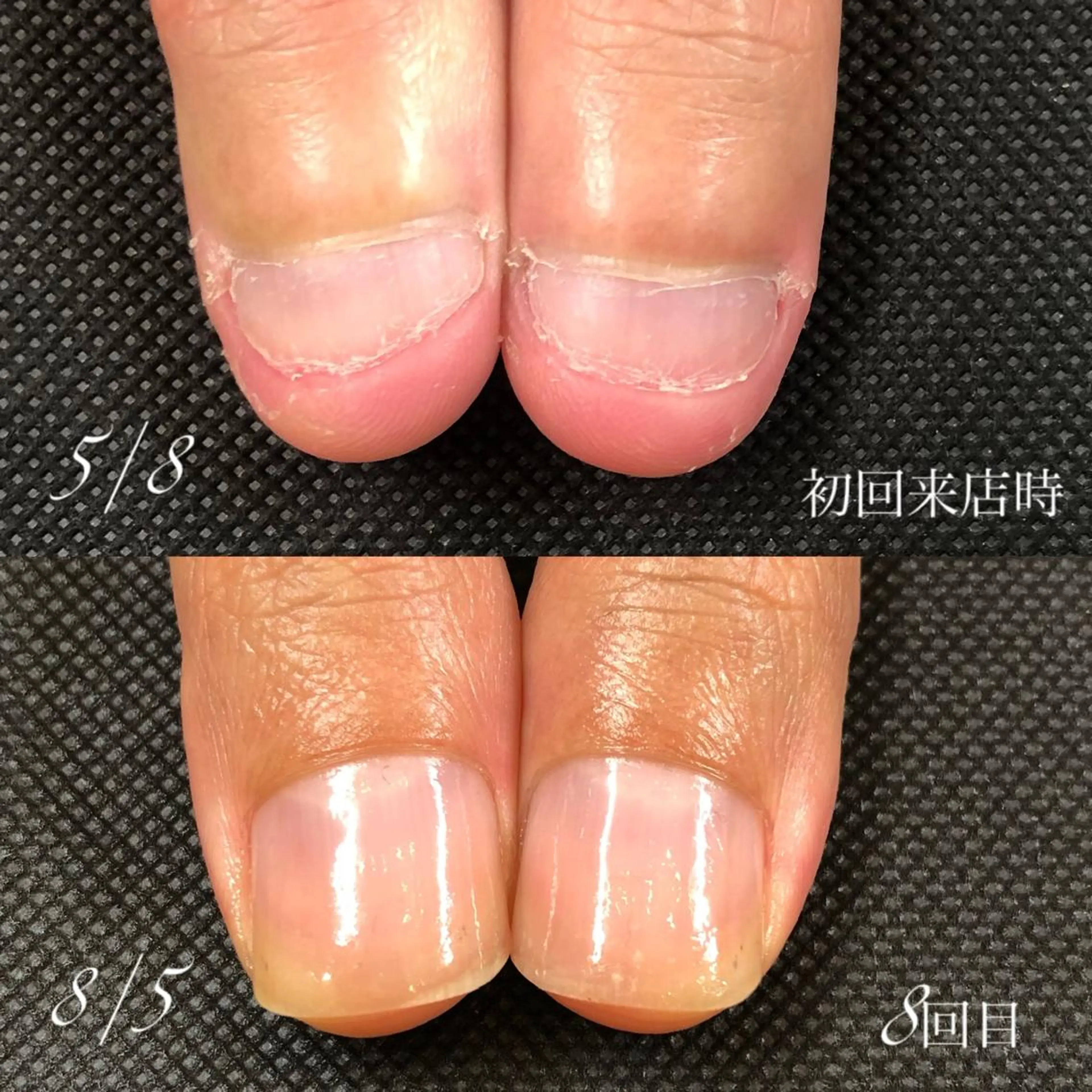 お試し『最強のネイルケア』の写真