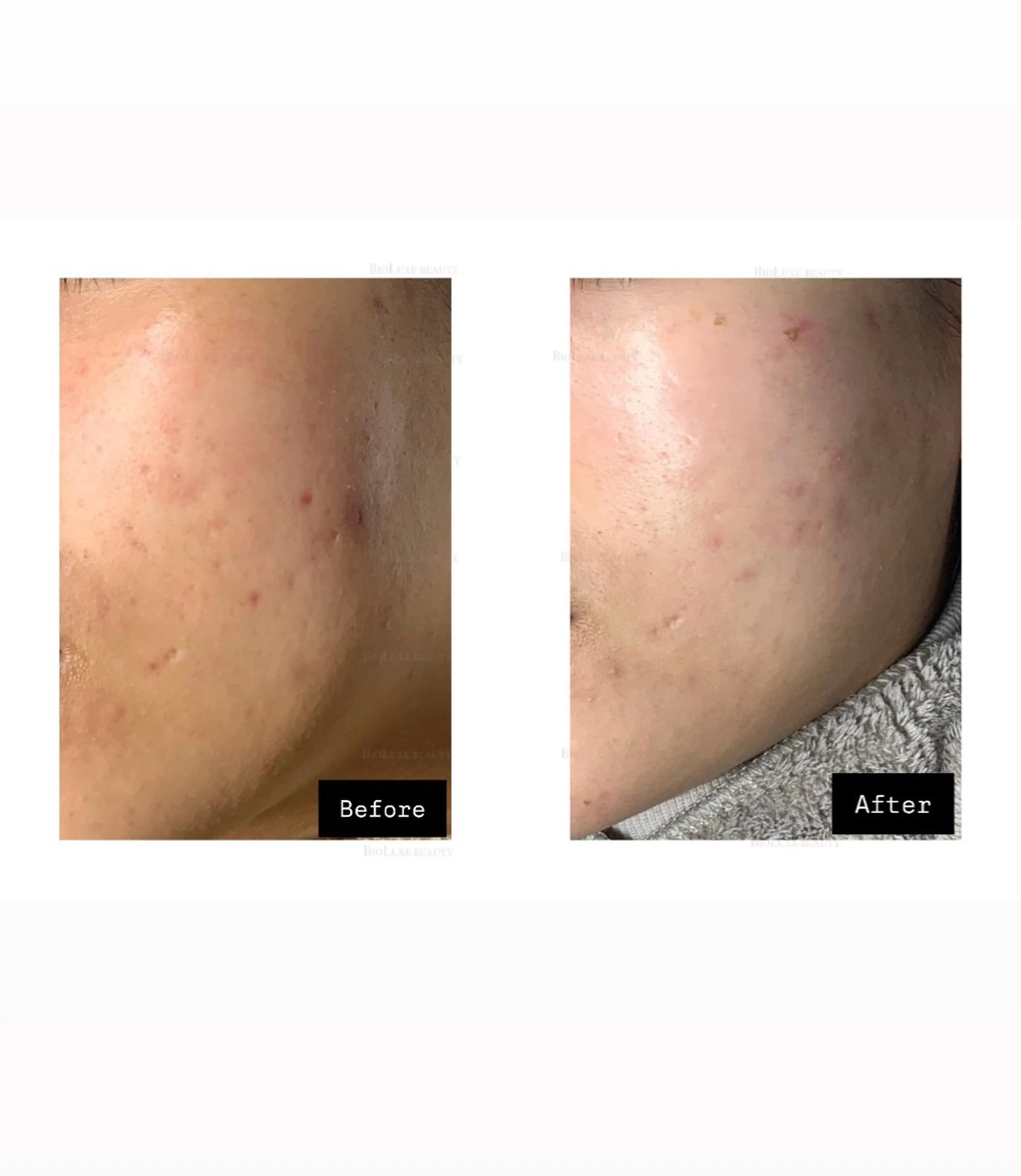 BIOLUXE BEAUTY所属・バイオラックス ビューティーのエステ・リラクイメージ