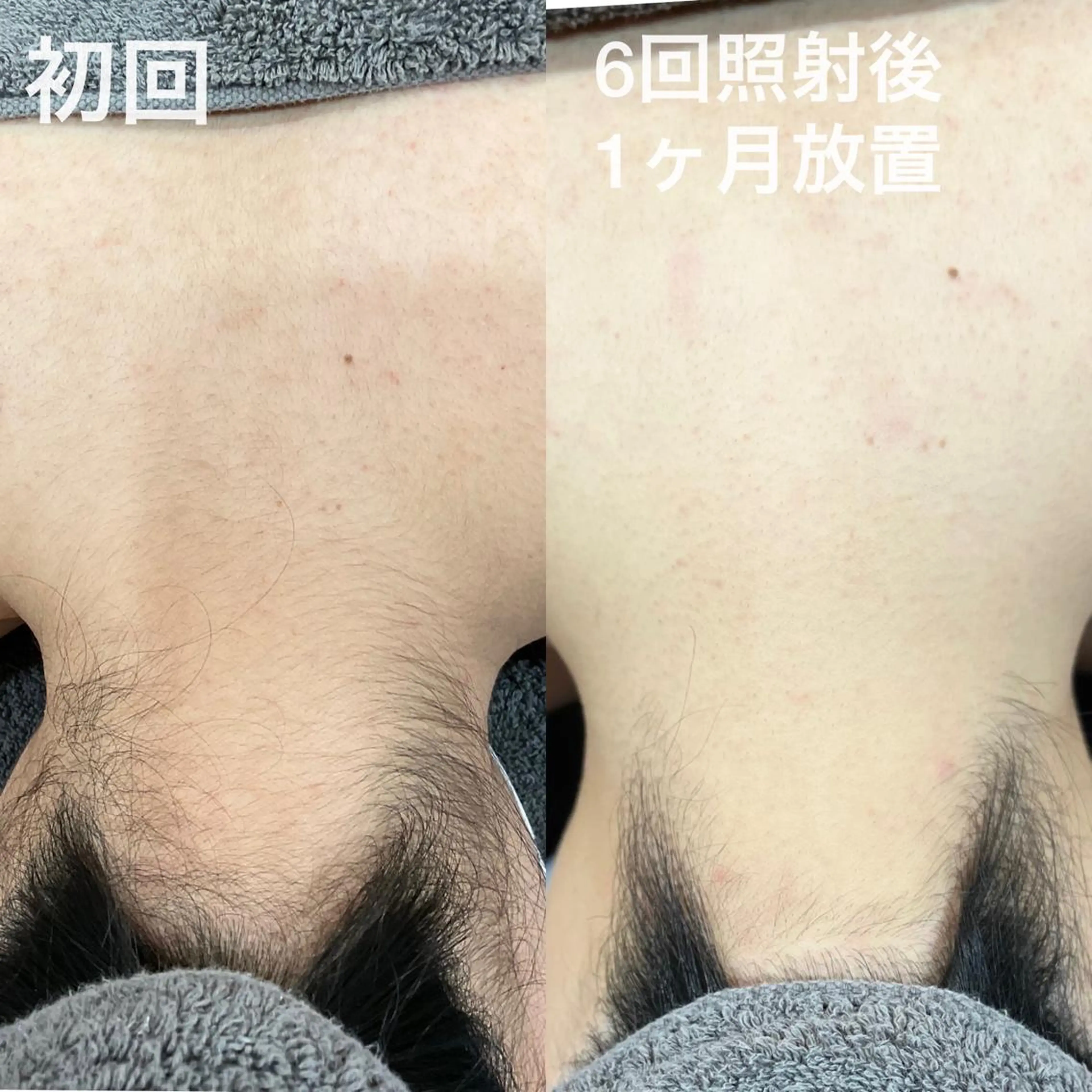 脱毛 KENASY所属・脱毛&アイブロウ/ KENASYの眉毛・アイブロウイメージ