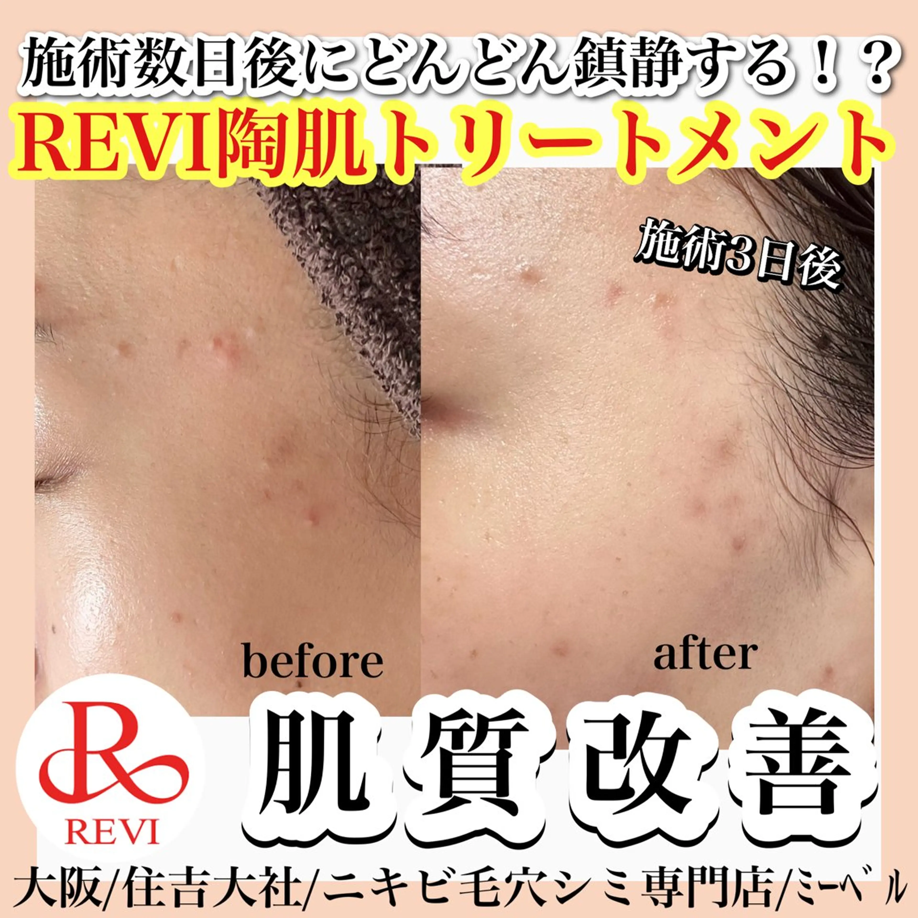 エステ salon  mebell所属・肌管理専門店 mebell天王寺店のエステ・リラクイメージ