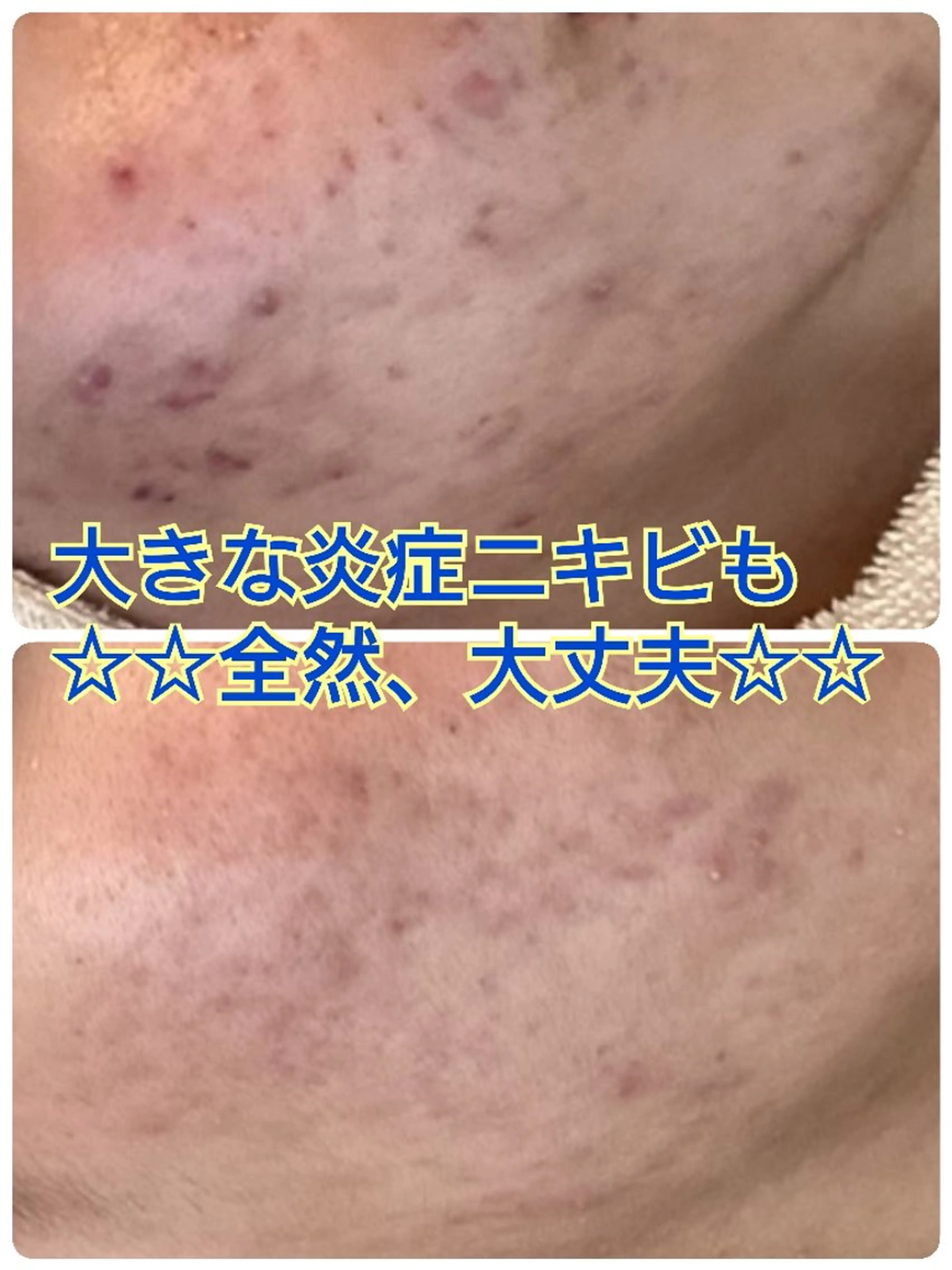 メンズ メンズ韓国風 エステ ハーブピーリング 専門店Kikkaのエステ・リラクイメージ