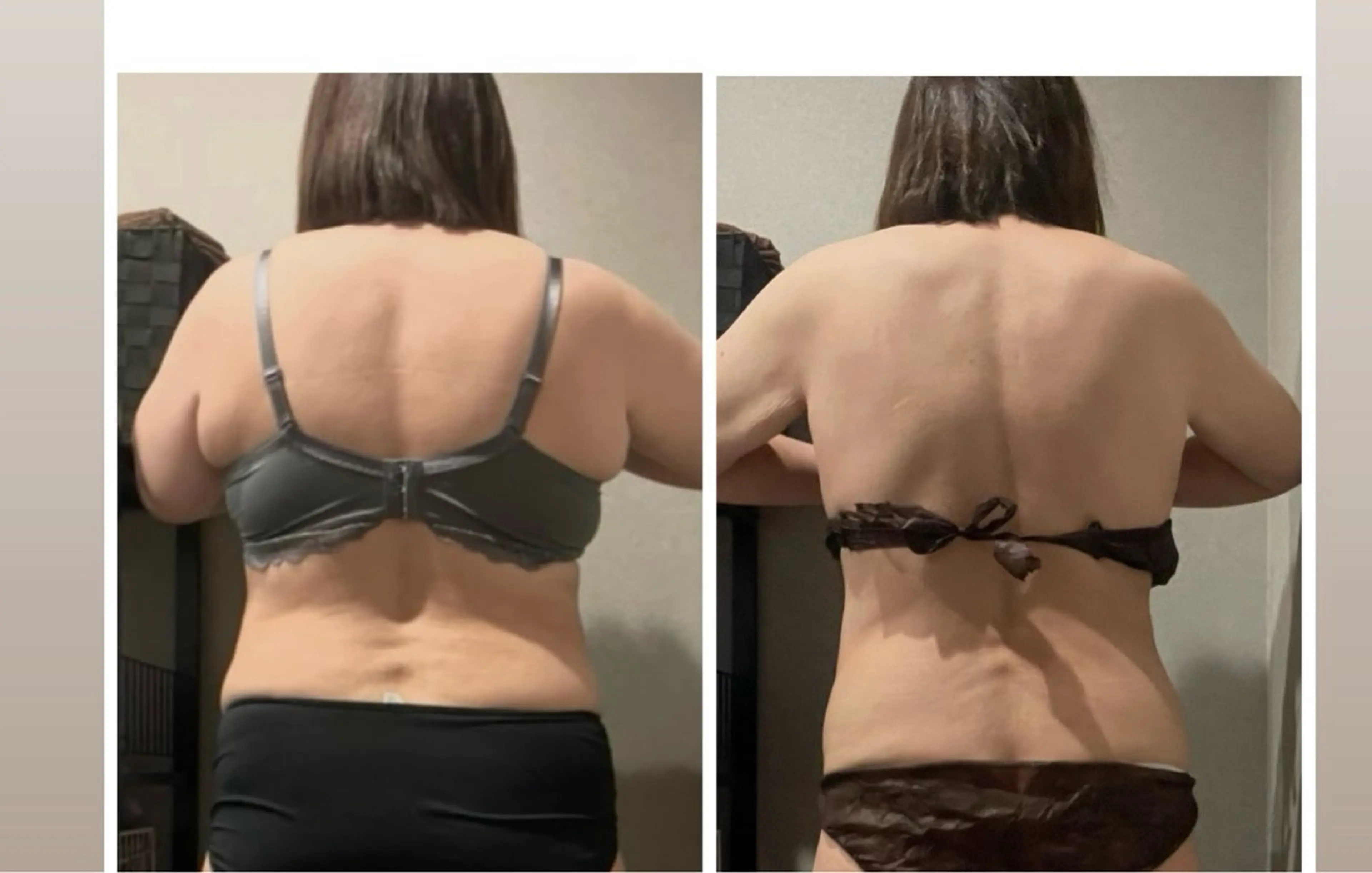 エステ エステ／ネイル/脱毛 R.Msalonのネイルデザイン