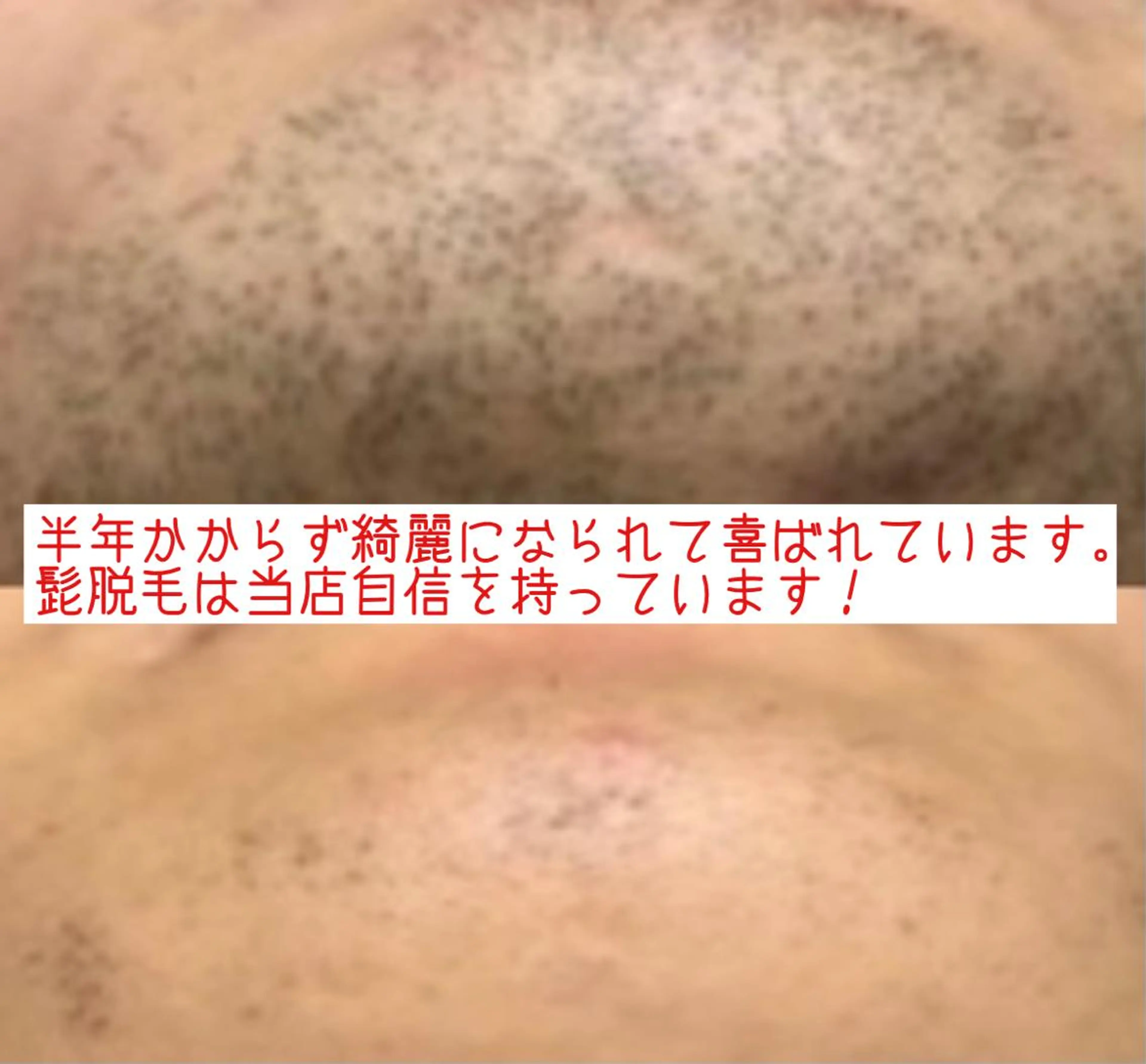 オアシス・さくら所属・中村貴子都度払い脱毛 小顔コルギのエステ・リラクイメージ