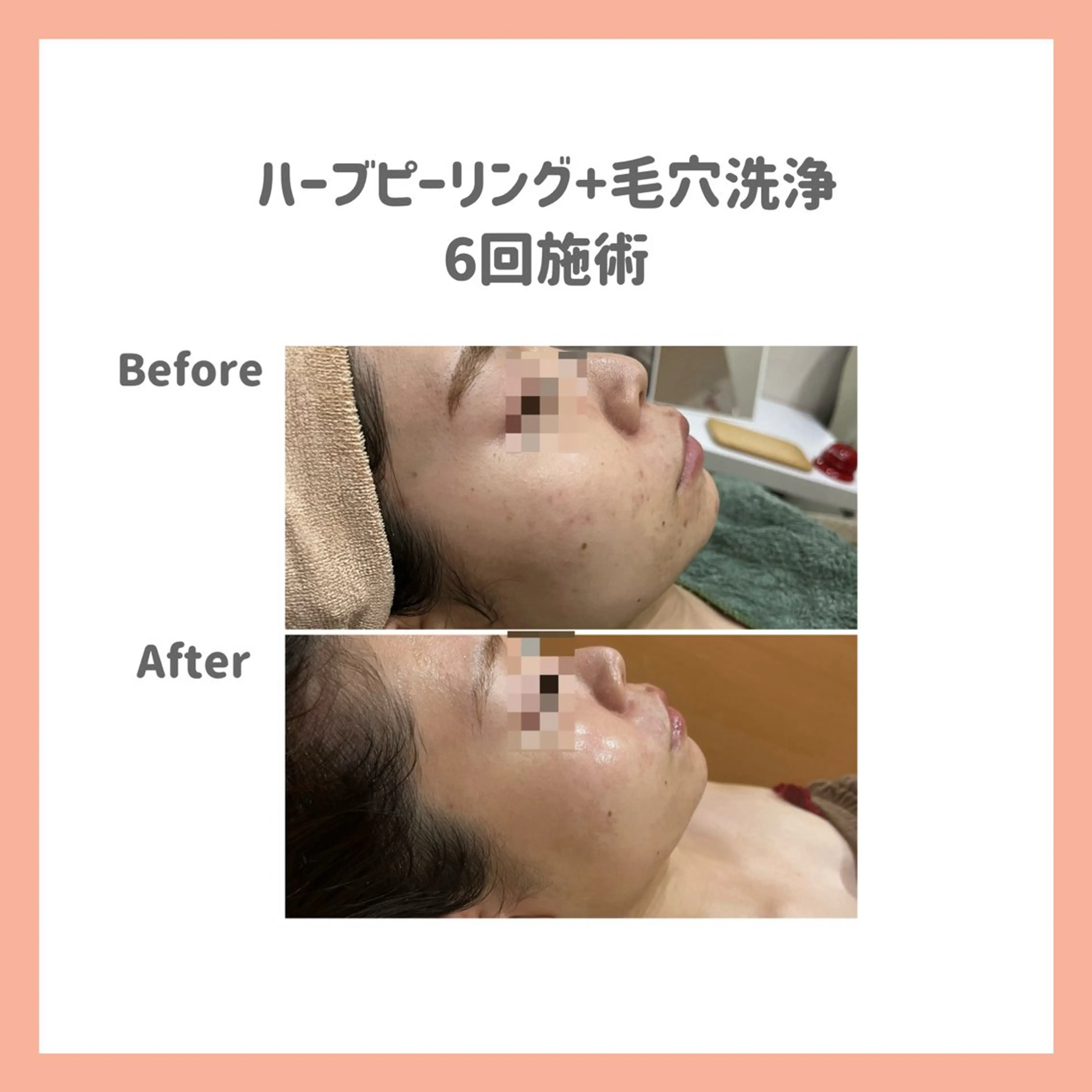 エステ 脱毛&フェイシャル 専門店muro.のエステ・リラクイメージ