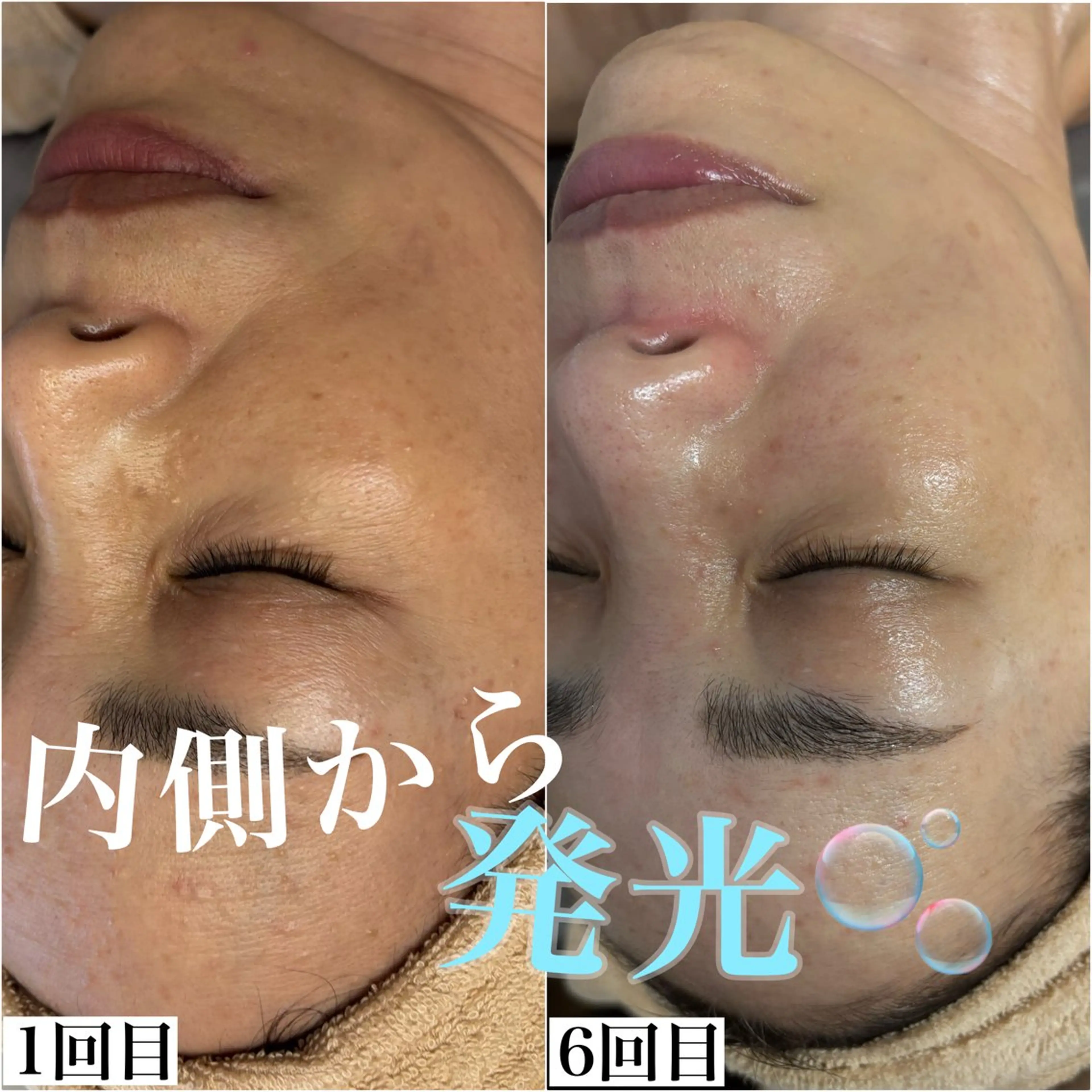 その他 WHITE AQUA 北千住店のエステ・リラクイメージ