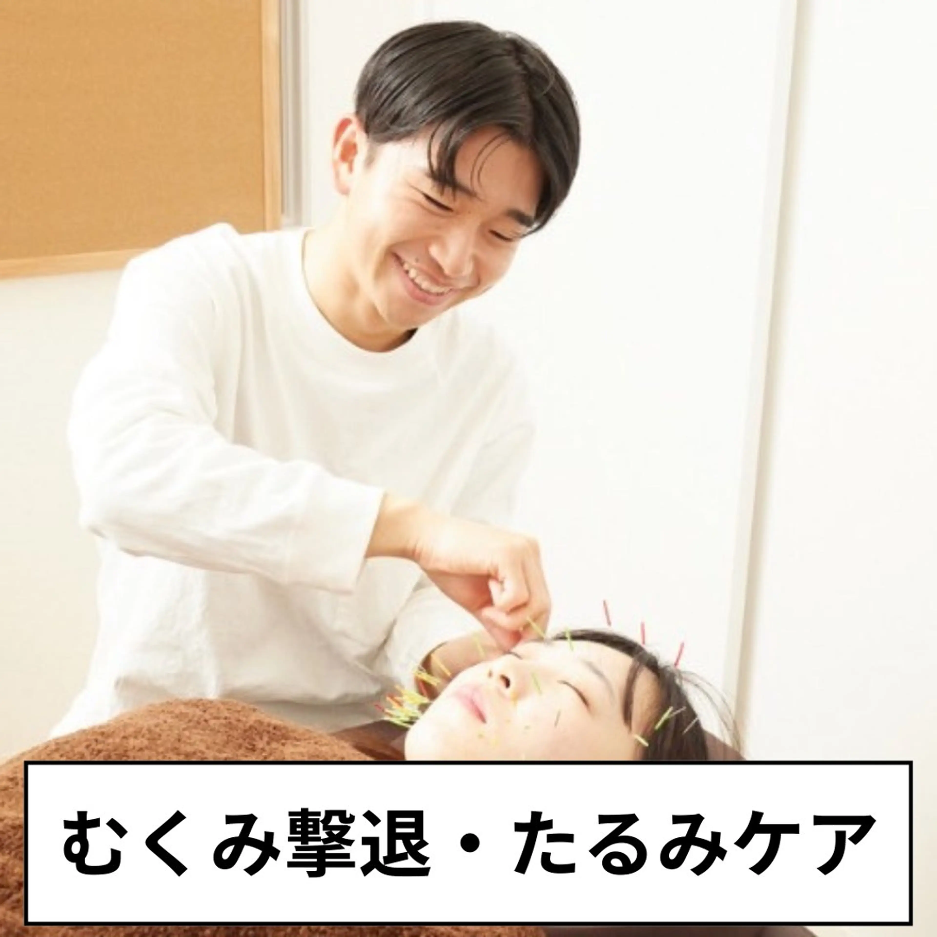 【12月限定☆小顔美容鍼】むくみ撃退＆たるみケア&歯ぎしり　¥10000→¥3980の写真