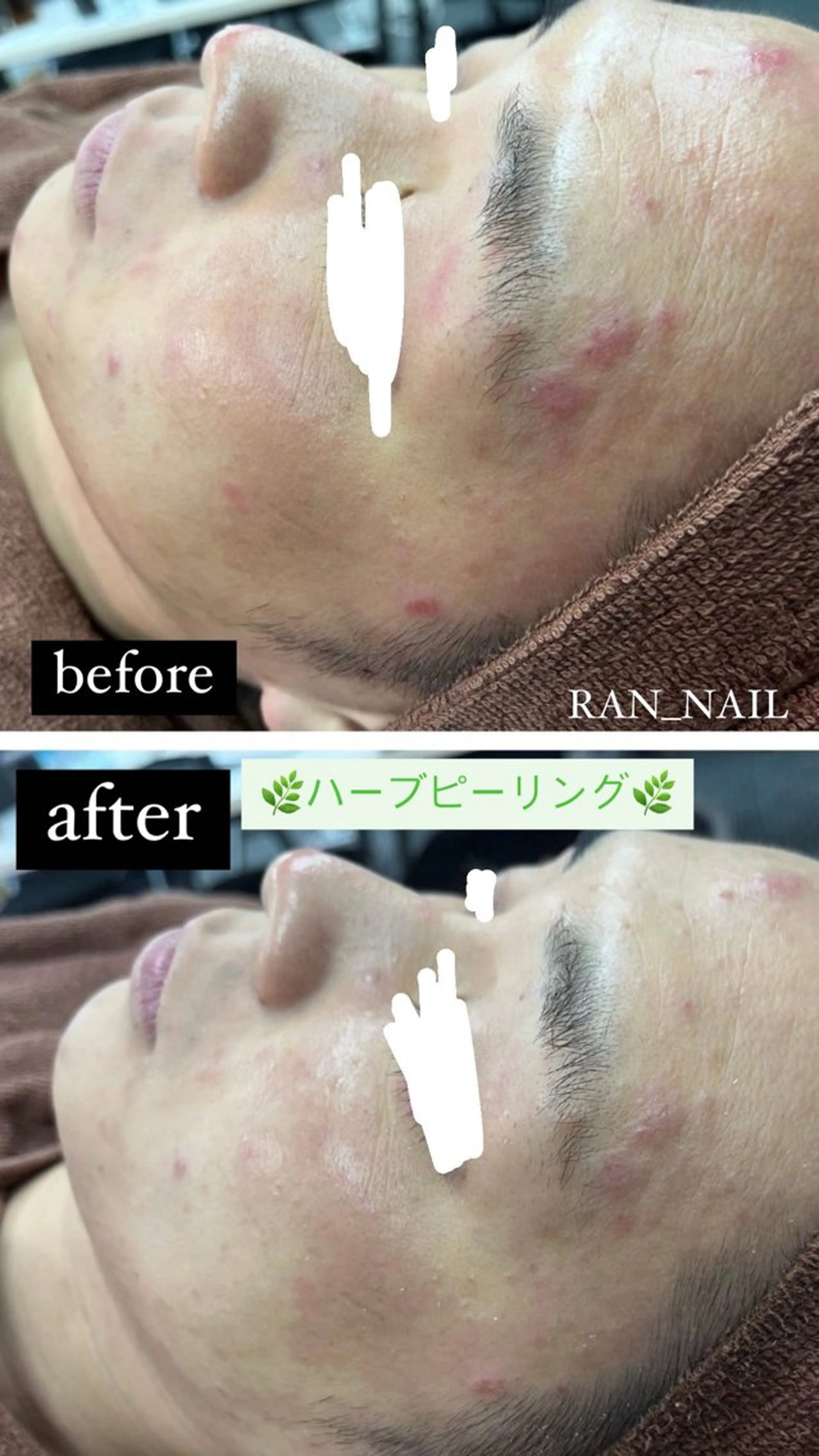 志免町 フェイスシャルエステのエステ・リラクイメージ