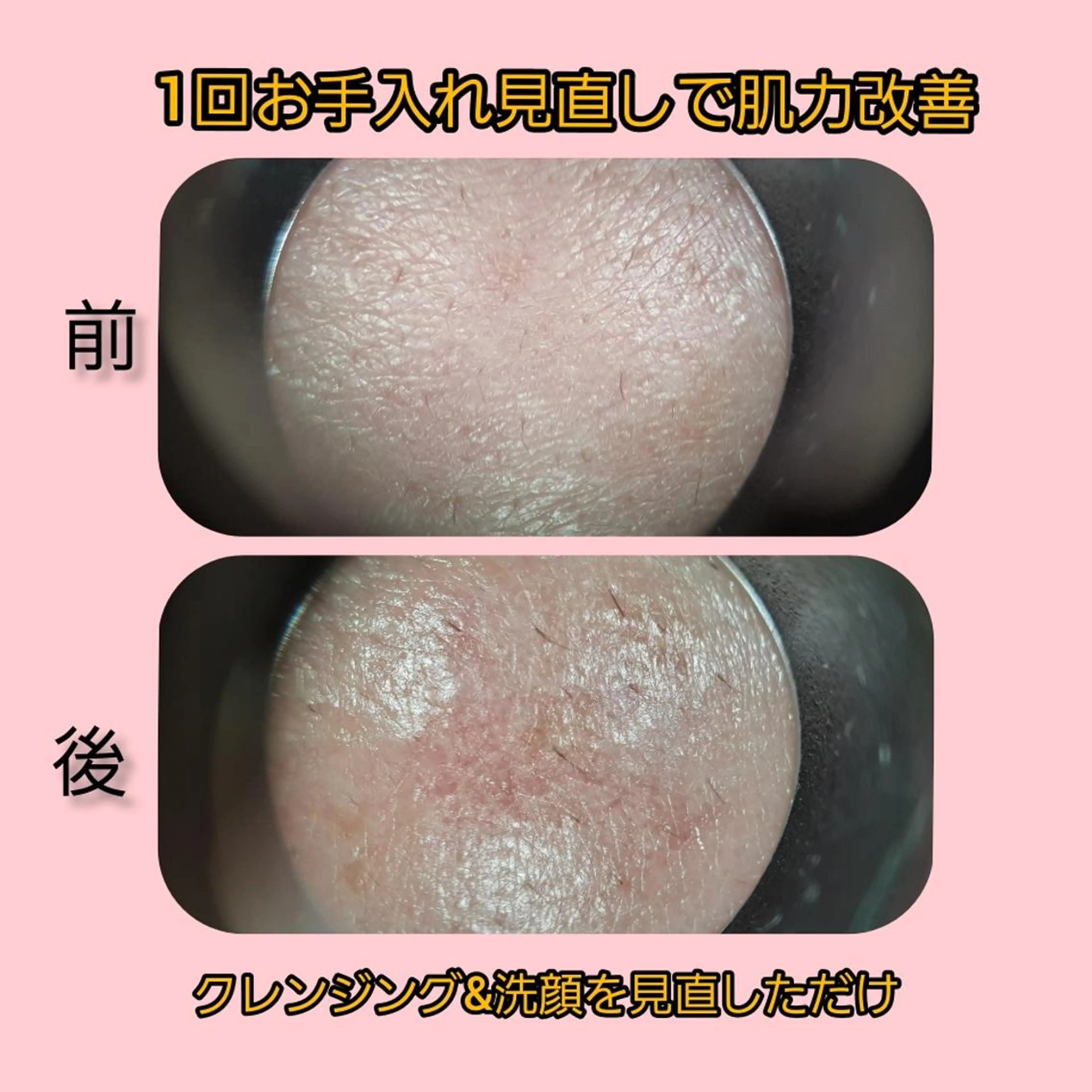 メナードフェイシャルサロン大曽根店所属・ごとう みさきのエステ・リラクイメージ