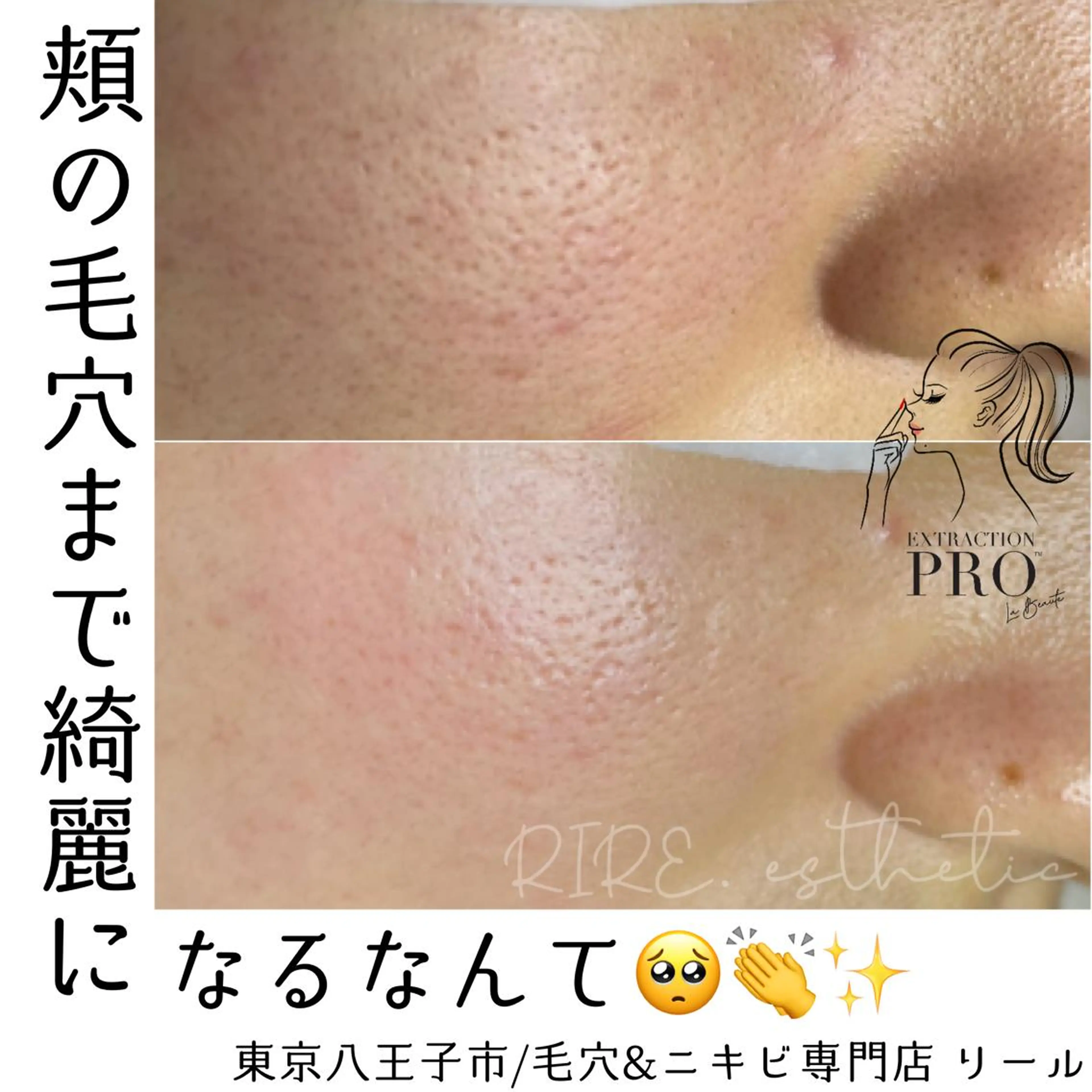 毛穴肌育専門店 リールのエステ・リラクイメージ