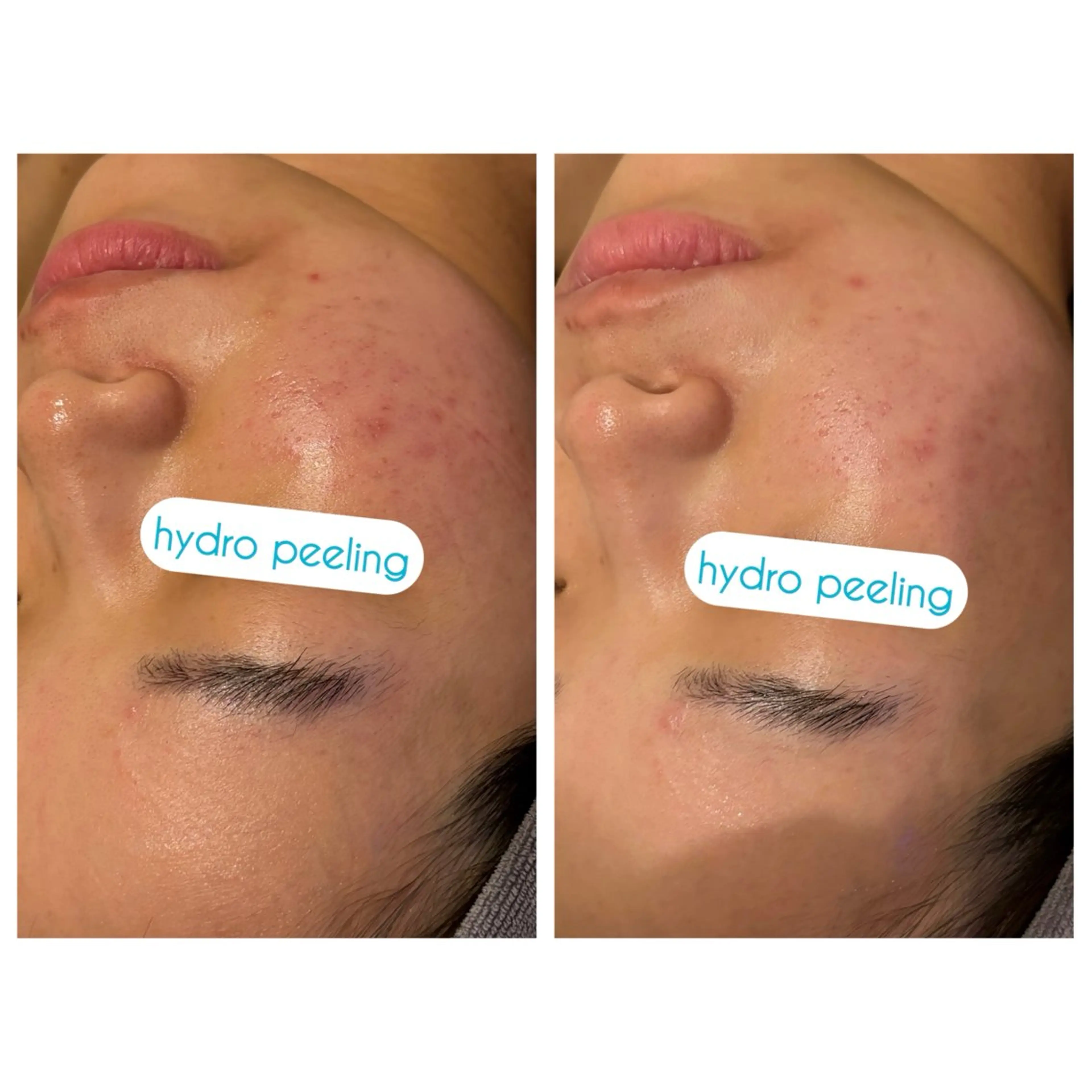 ☆痩身/小顔☆ 結果出します☆のエステ・リラクイメージ