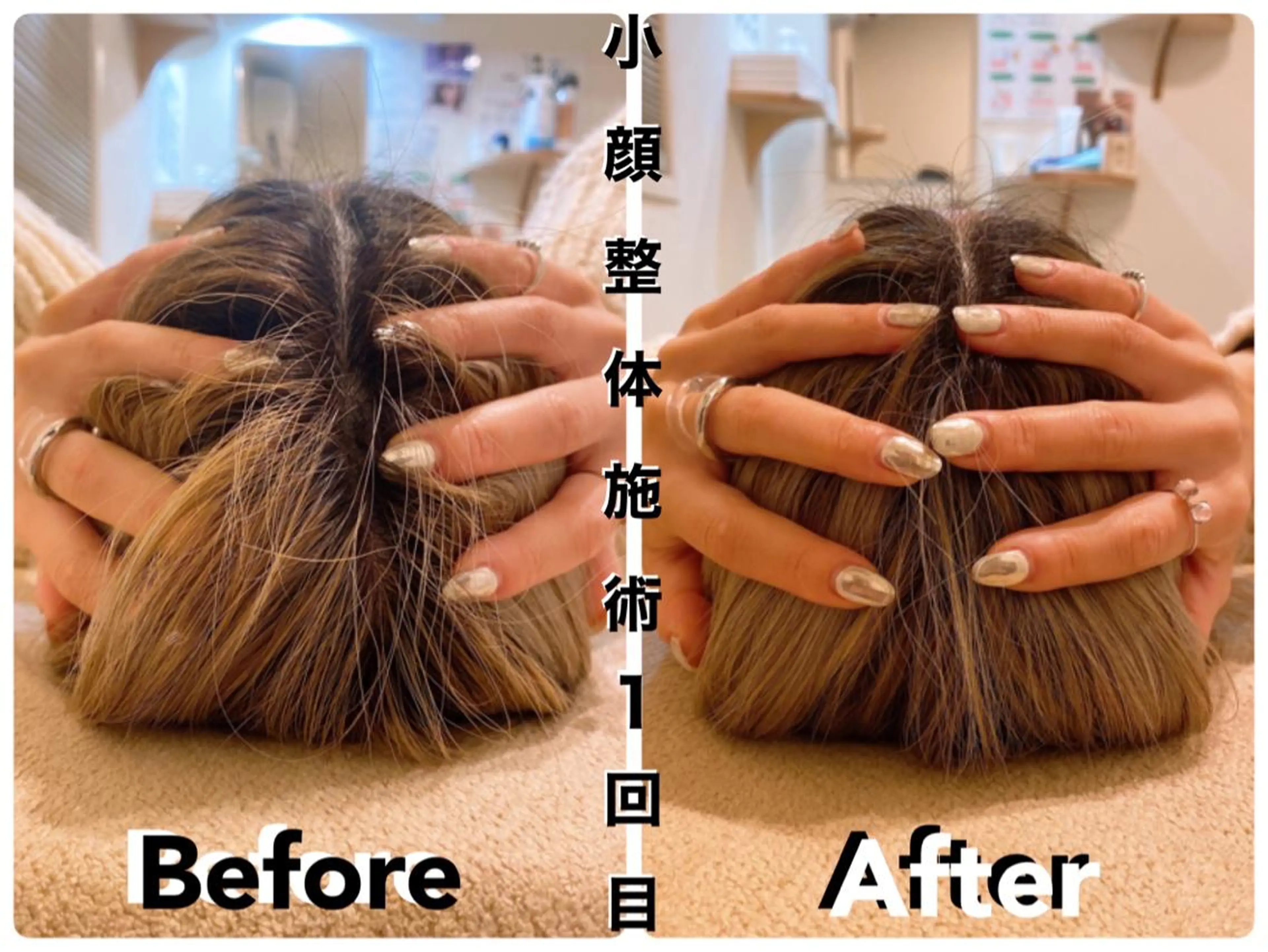 鍼灸整骨院Refine所属・鍼灸 Refineのその他イメージ